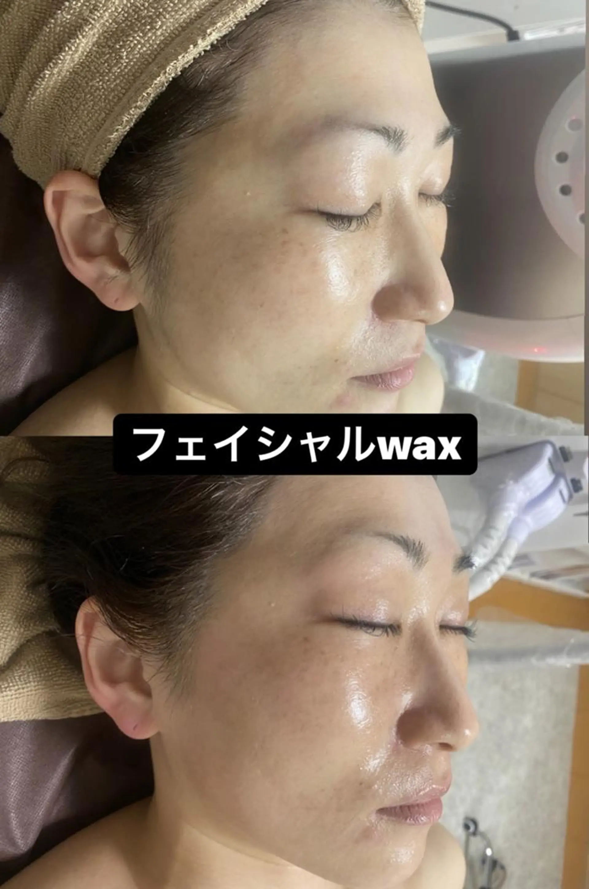 Epina 千葉店 【エピナ】のエステ・リラクイメージ