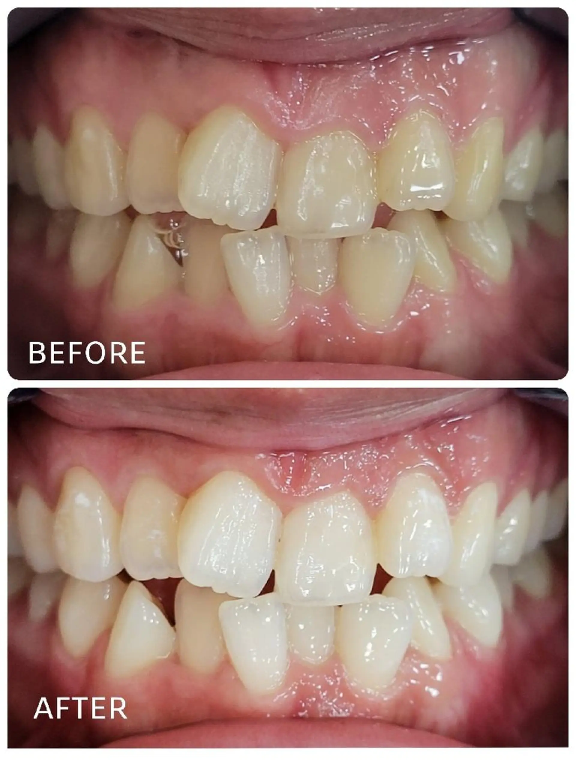 ホワイトニングサロン ラウレアのその他イメージ