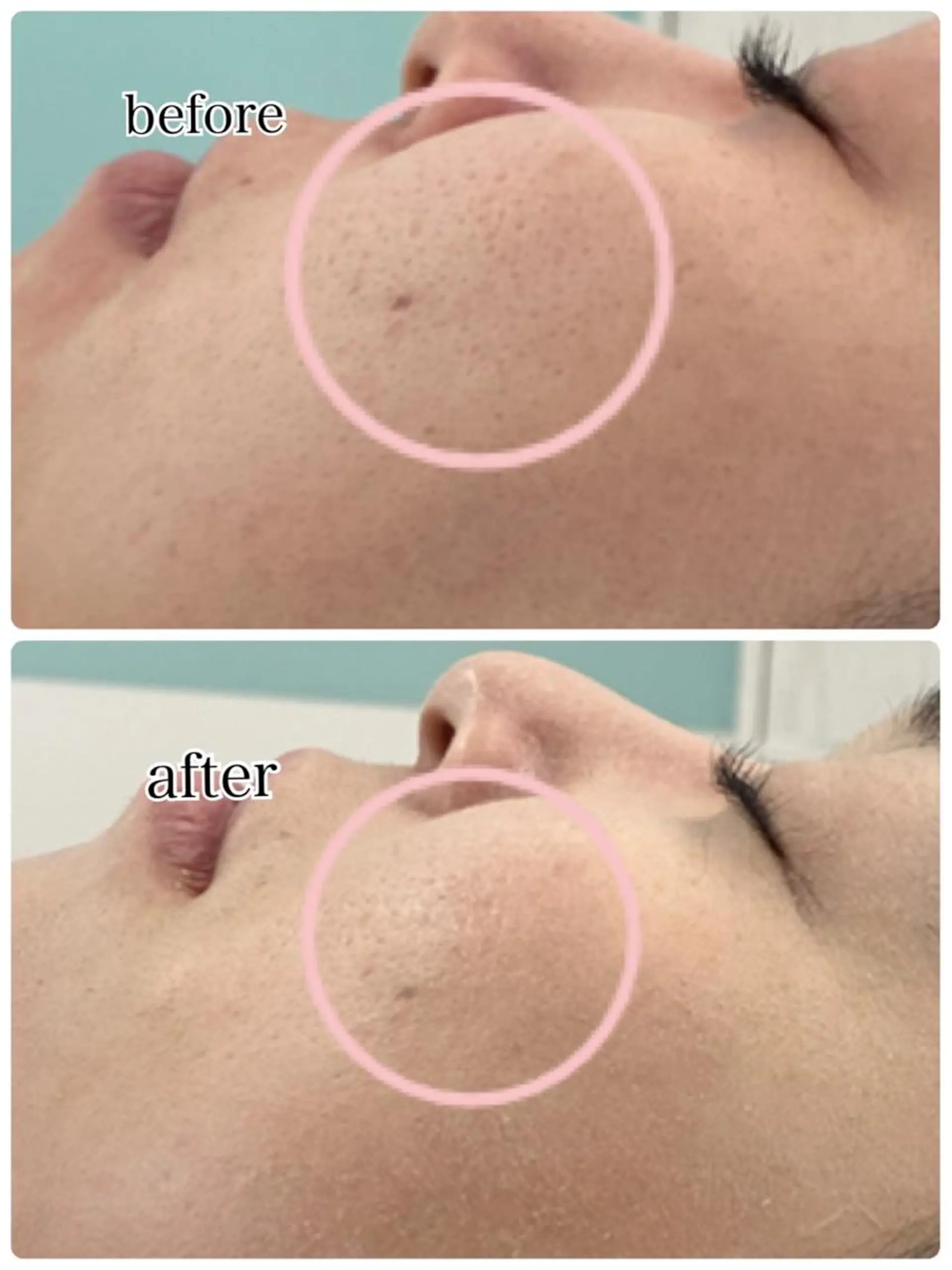 総合エステサロン 肌活のエステ・リラクイメージ