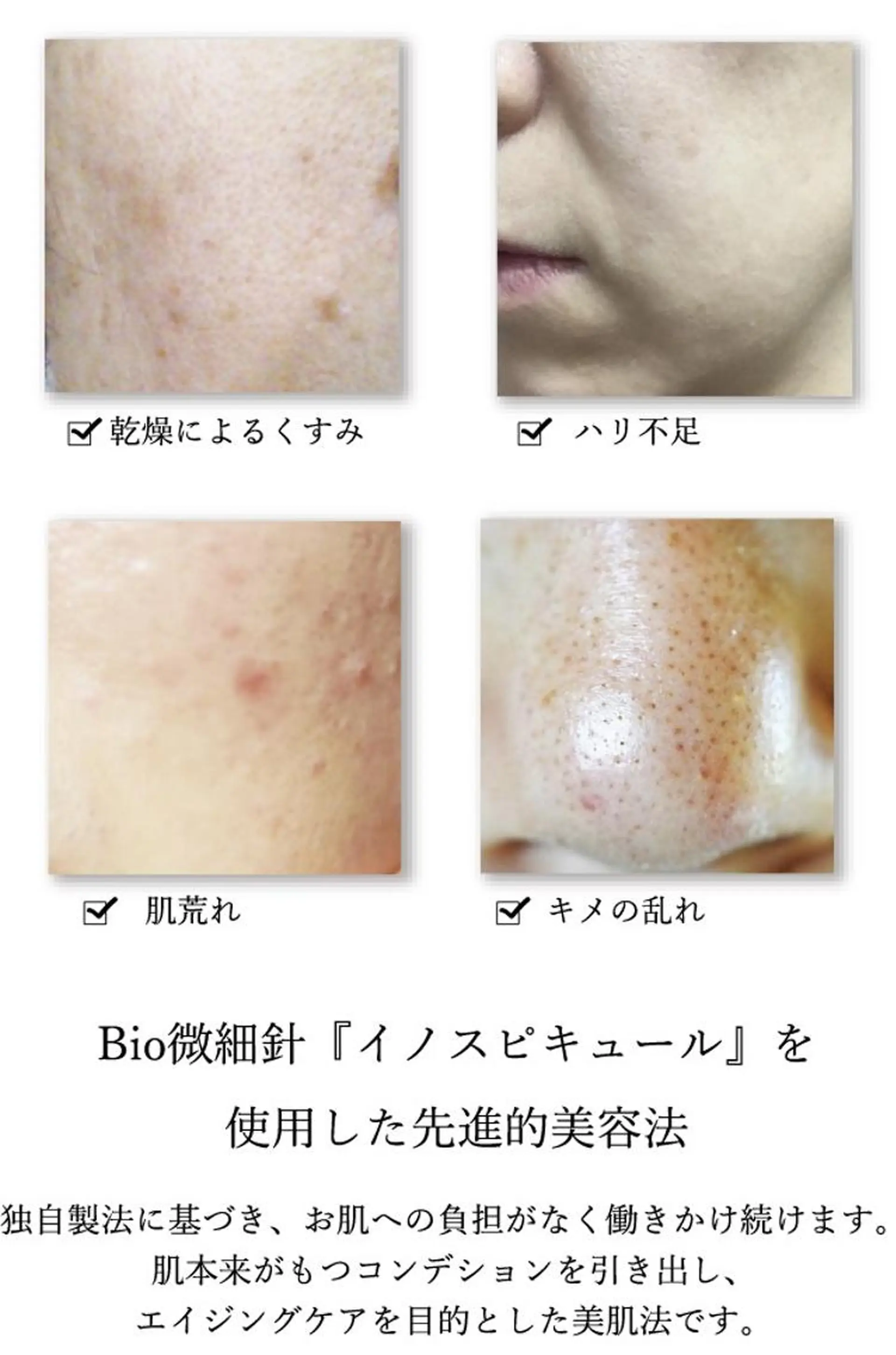 エステ EYE LASH LAPISのエステ・リラクイメージ