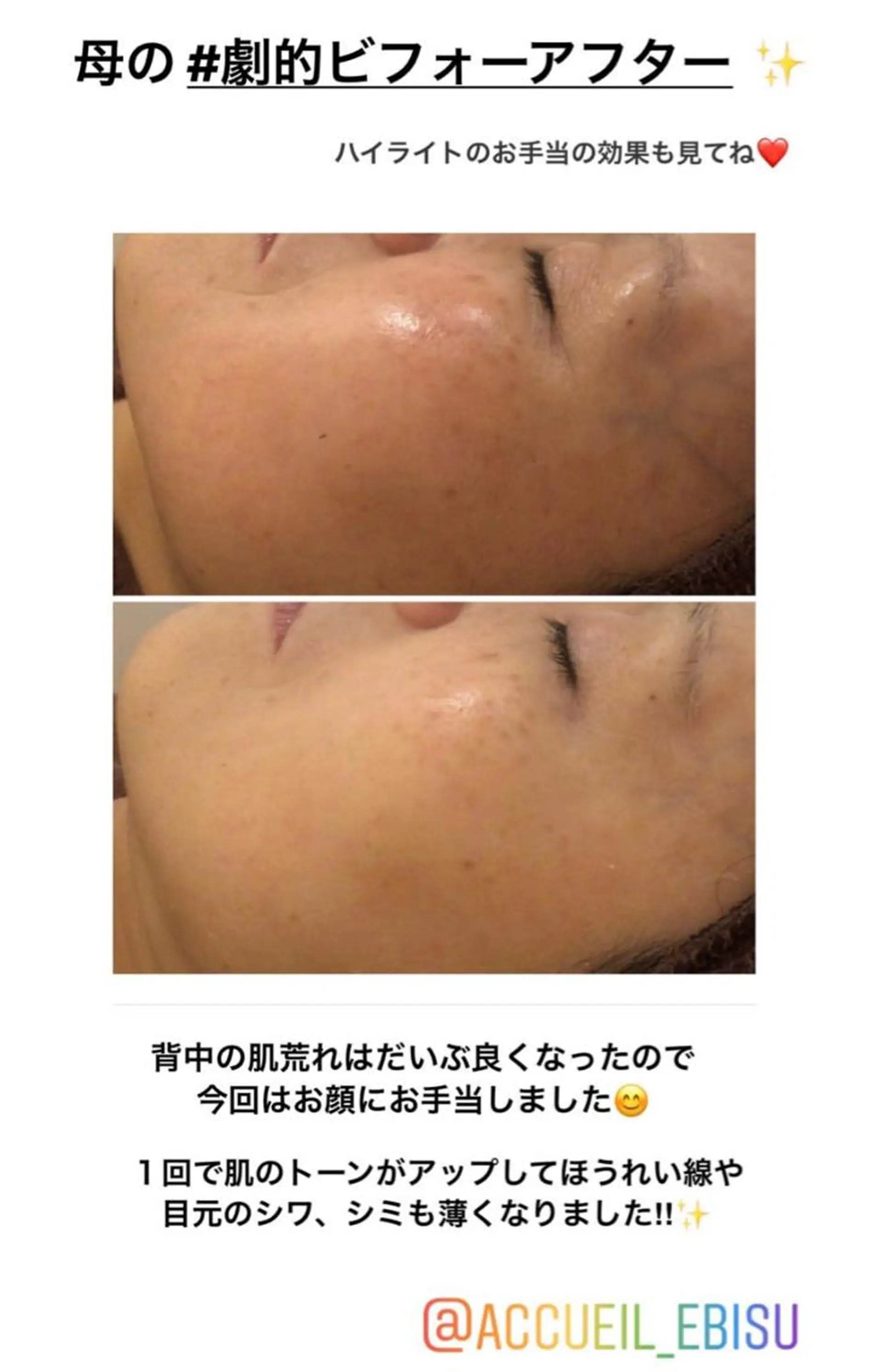 ミディアム カラー パーマ ヘアアレンジ メンズ キッズ ネイル マツエク・マツパ エステ リラク ニキビ・肌質改善専門 ♡人生が変わるサロンのエステ・リラクイメージ