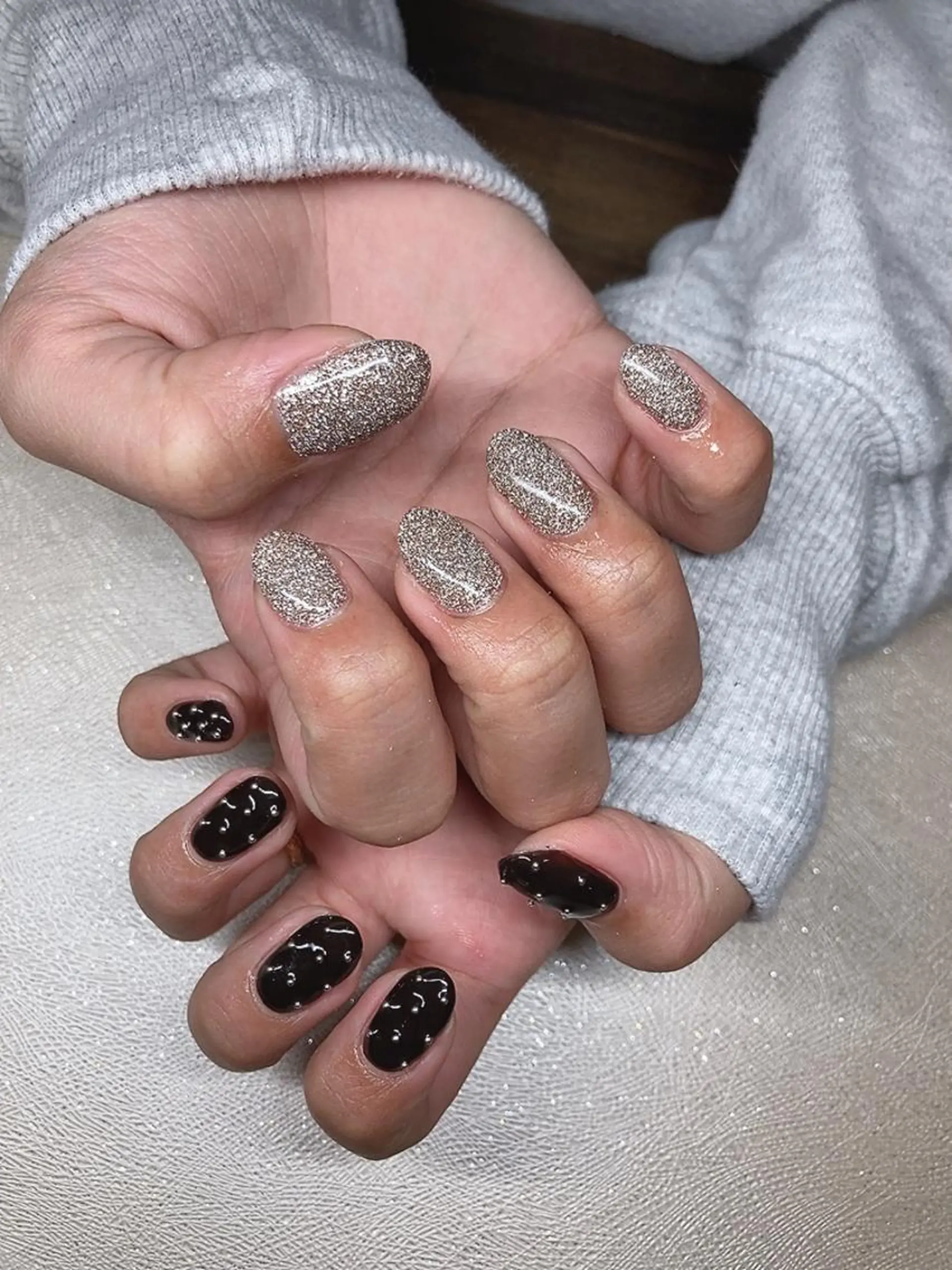 ネイル 𝐴𝑁𝑈𝐸 トラブル爪育成専門のネイルデザイン