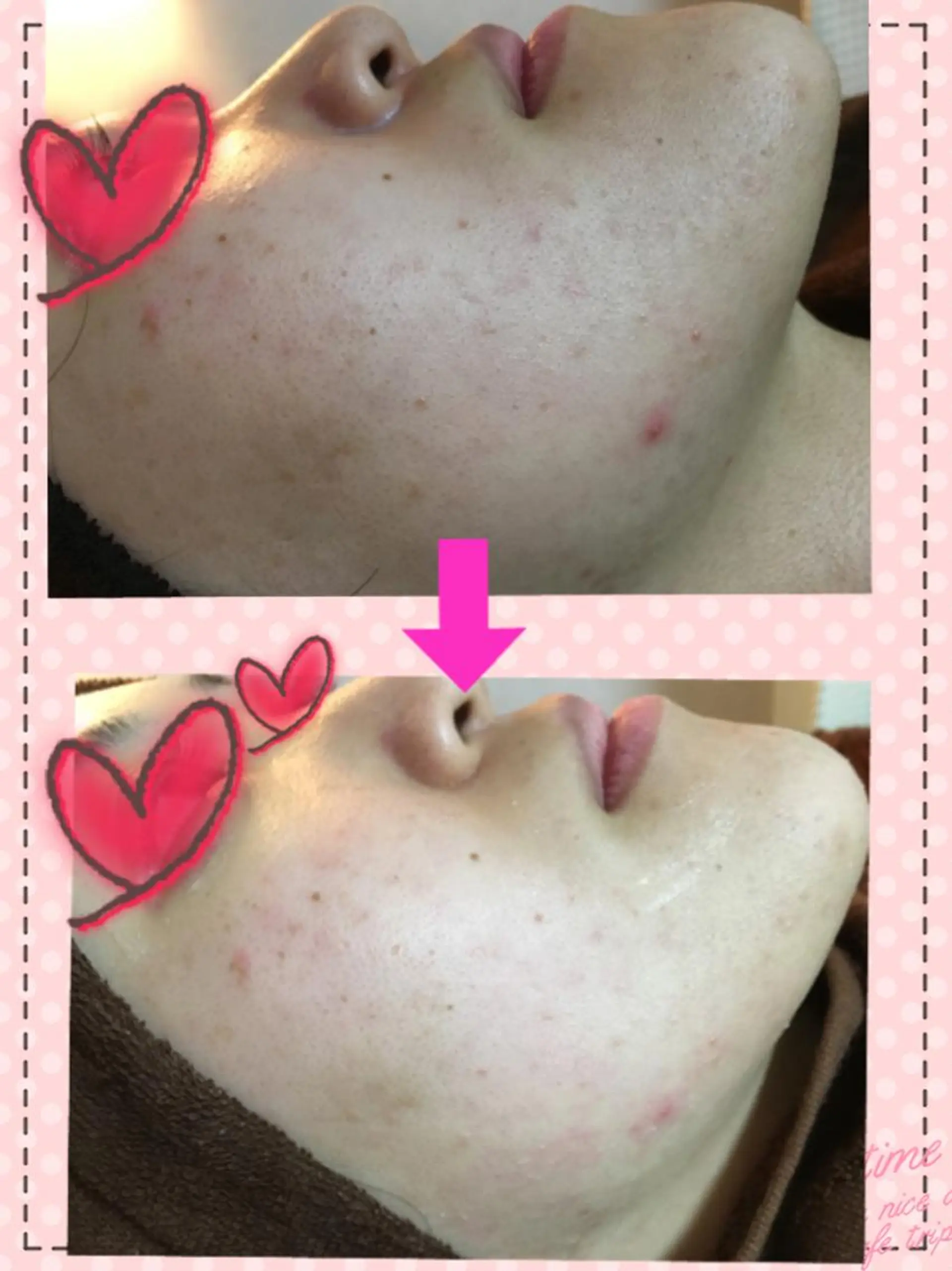 痩身リンパダイエット 隠れ家サロンチャームのエステ・リラクイメージ