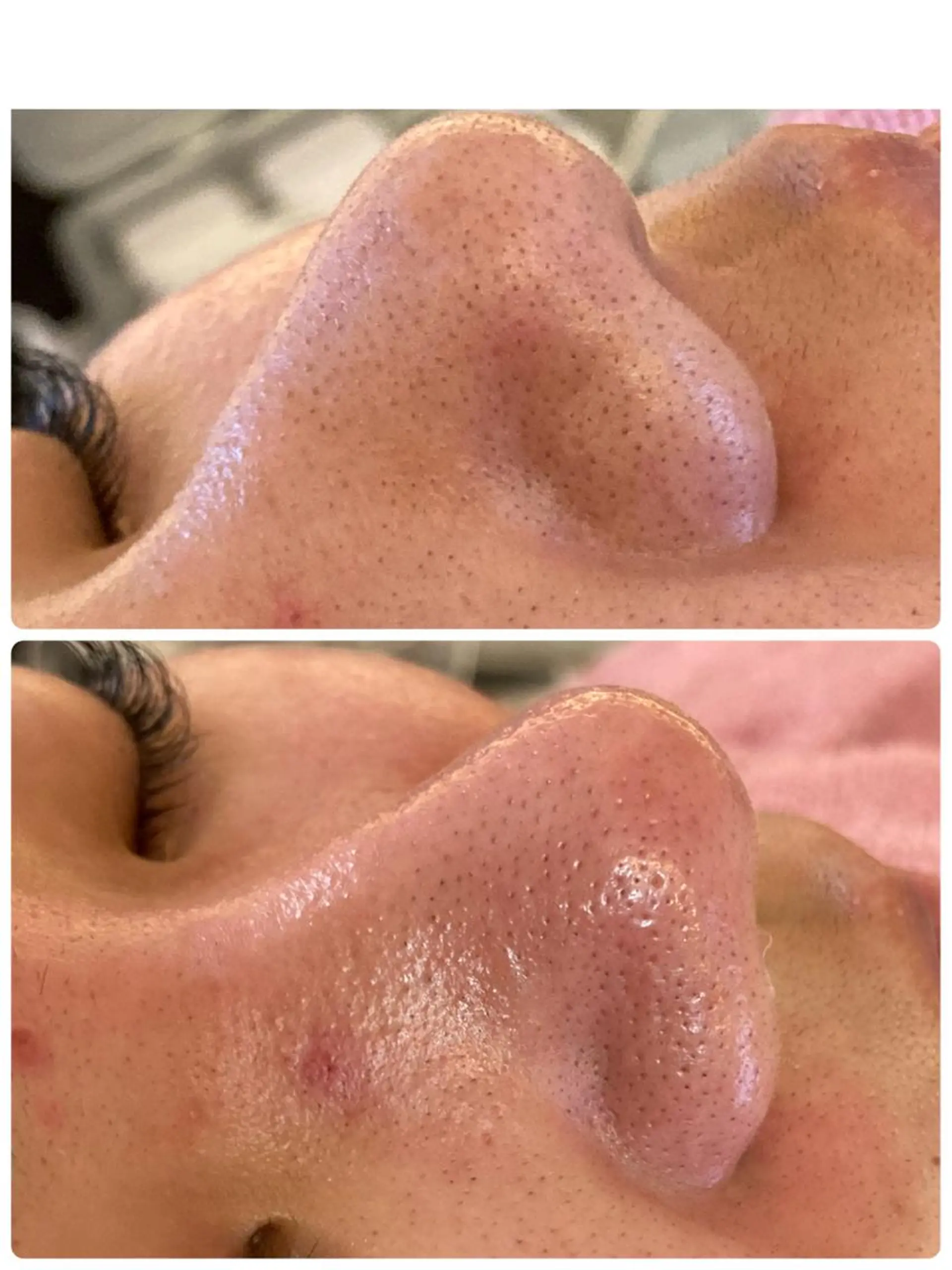 エステ 山田 美夕紀のエステ・リラクイメージ