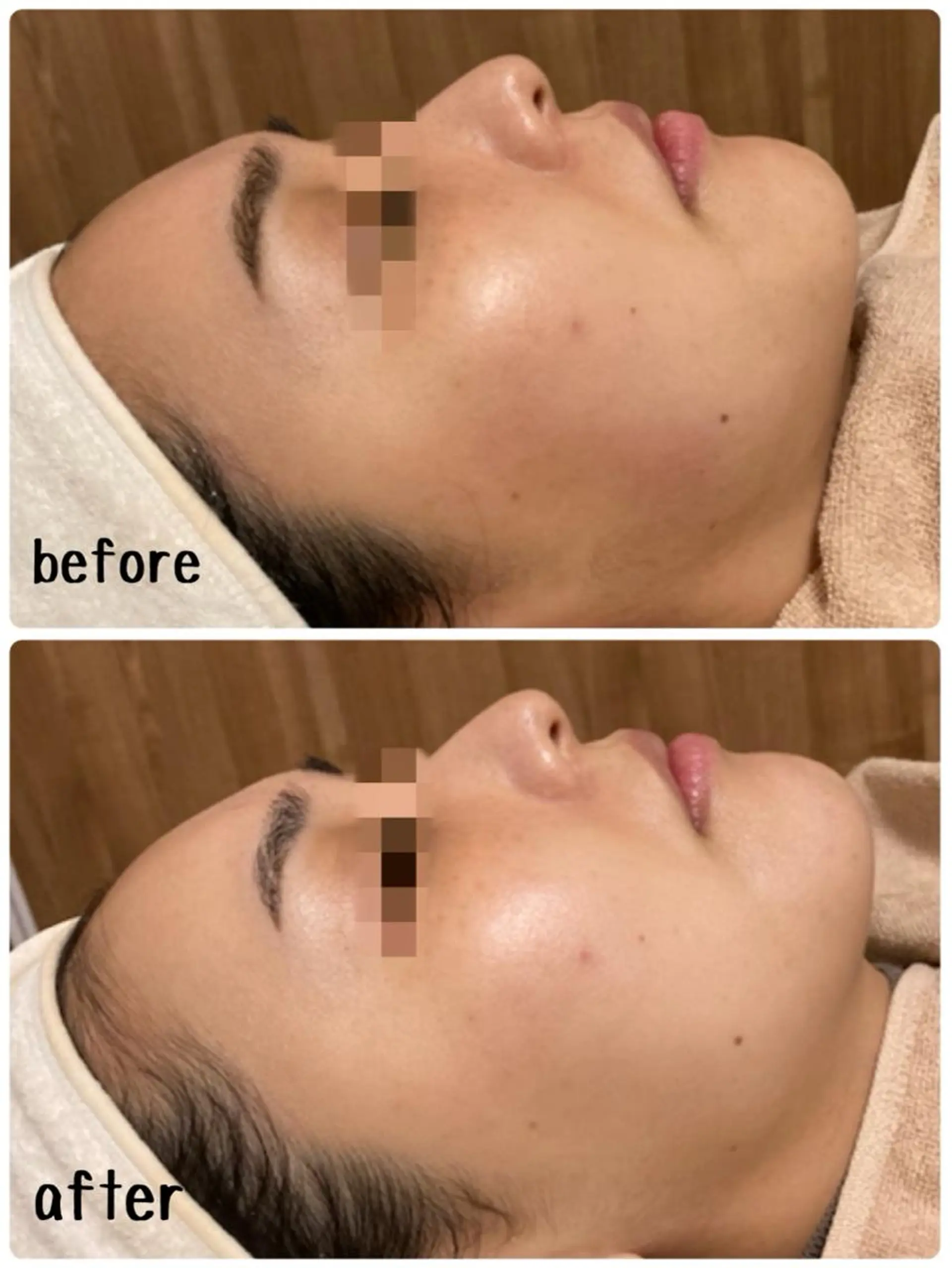 肌質改善サロン chouchouのエステ・リラクイメージ