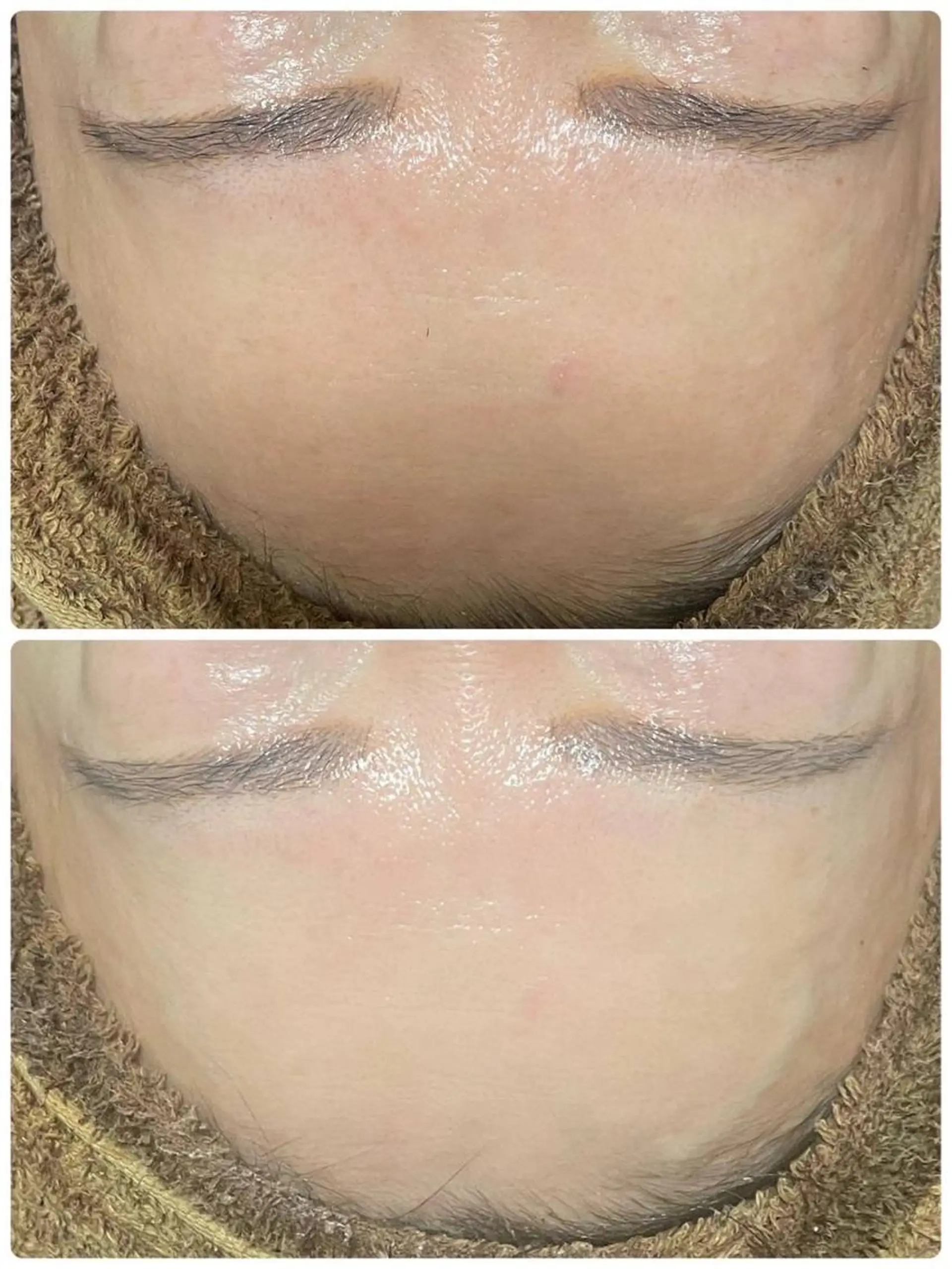 エステ Feel♡ JYURIAのネイルデザイン