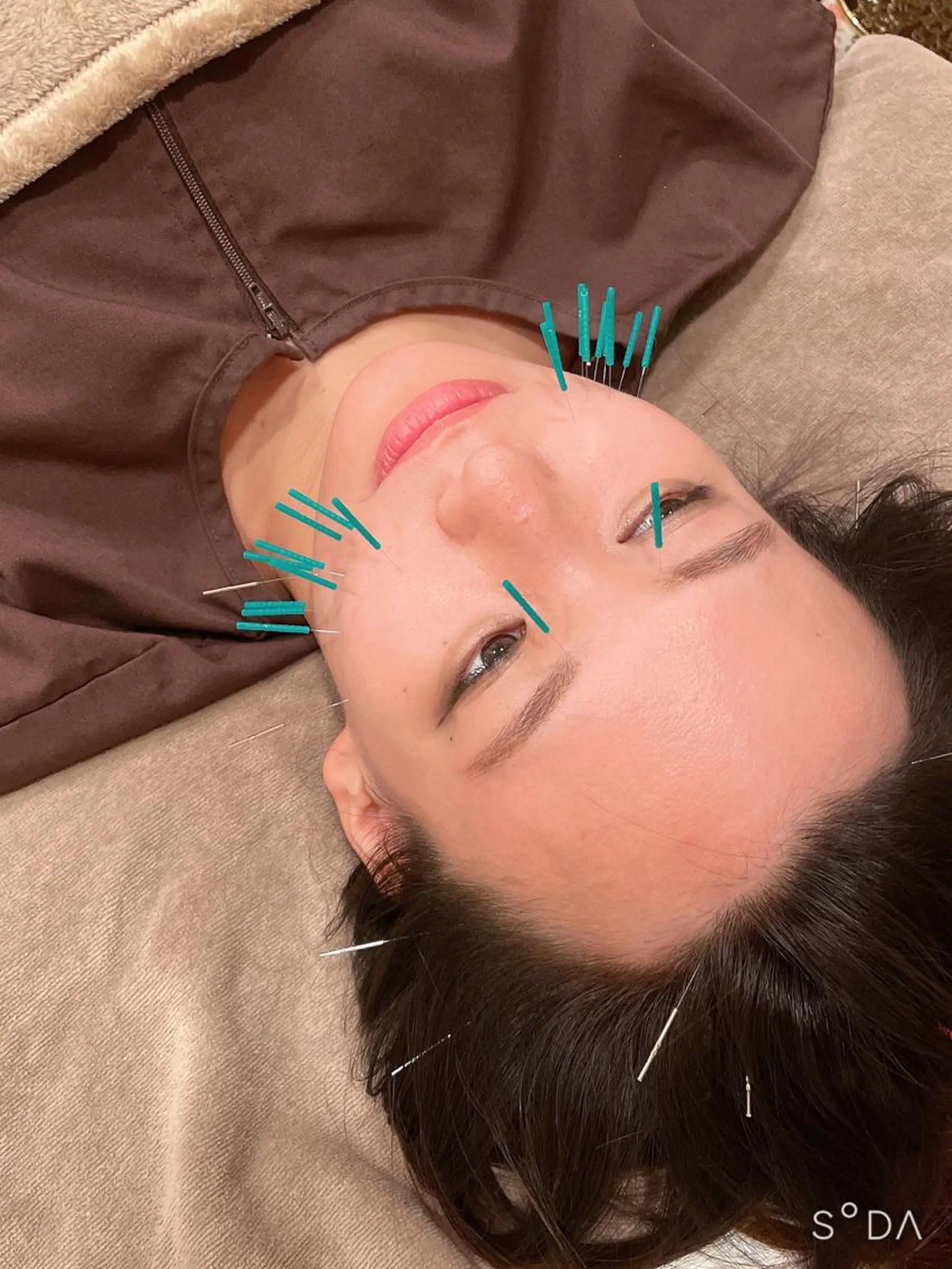 美容鍼灸サロン      APLUS所属・美容鍼灸サロン APLUSのエステ・リラクイメージ