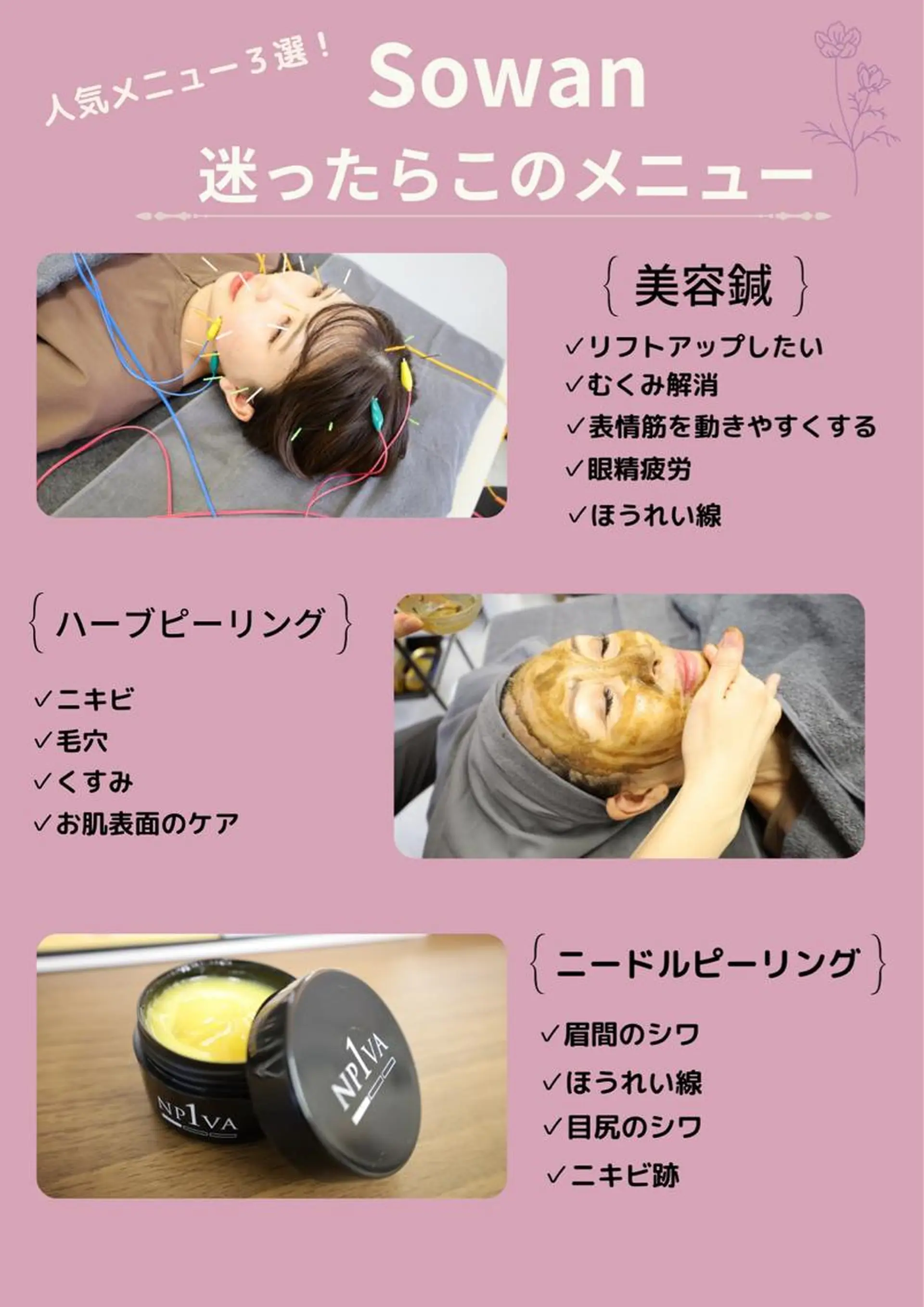 ニキビ特化美容鍼 ×ハーブピーリングのエステ・リラクイメージ