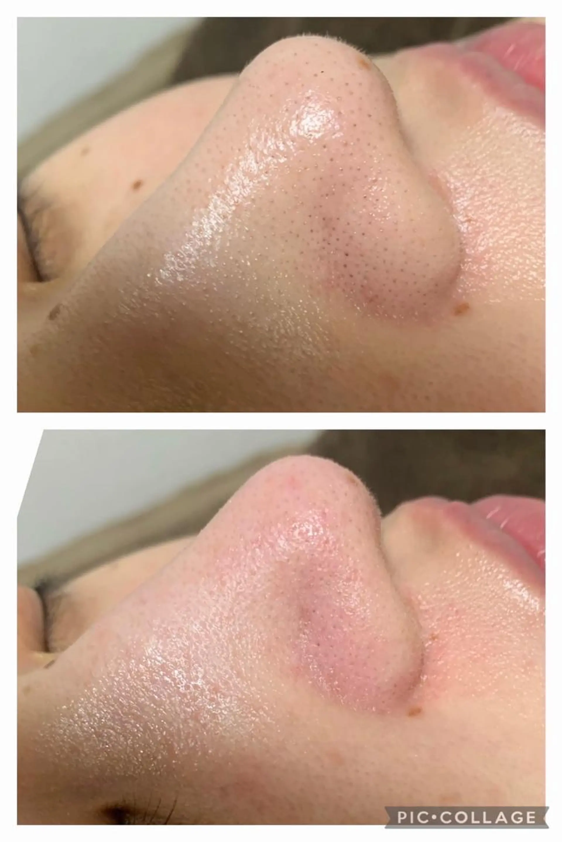 メンズ 朝重い人専用 肩甲骨調整のエステ・リラクイメージ