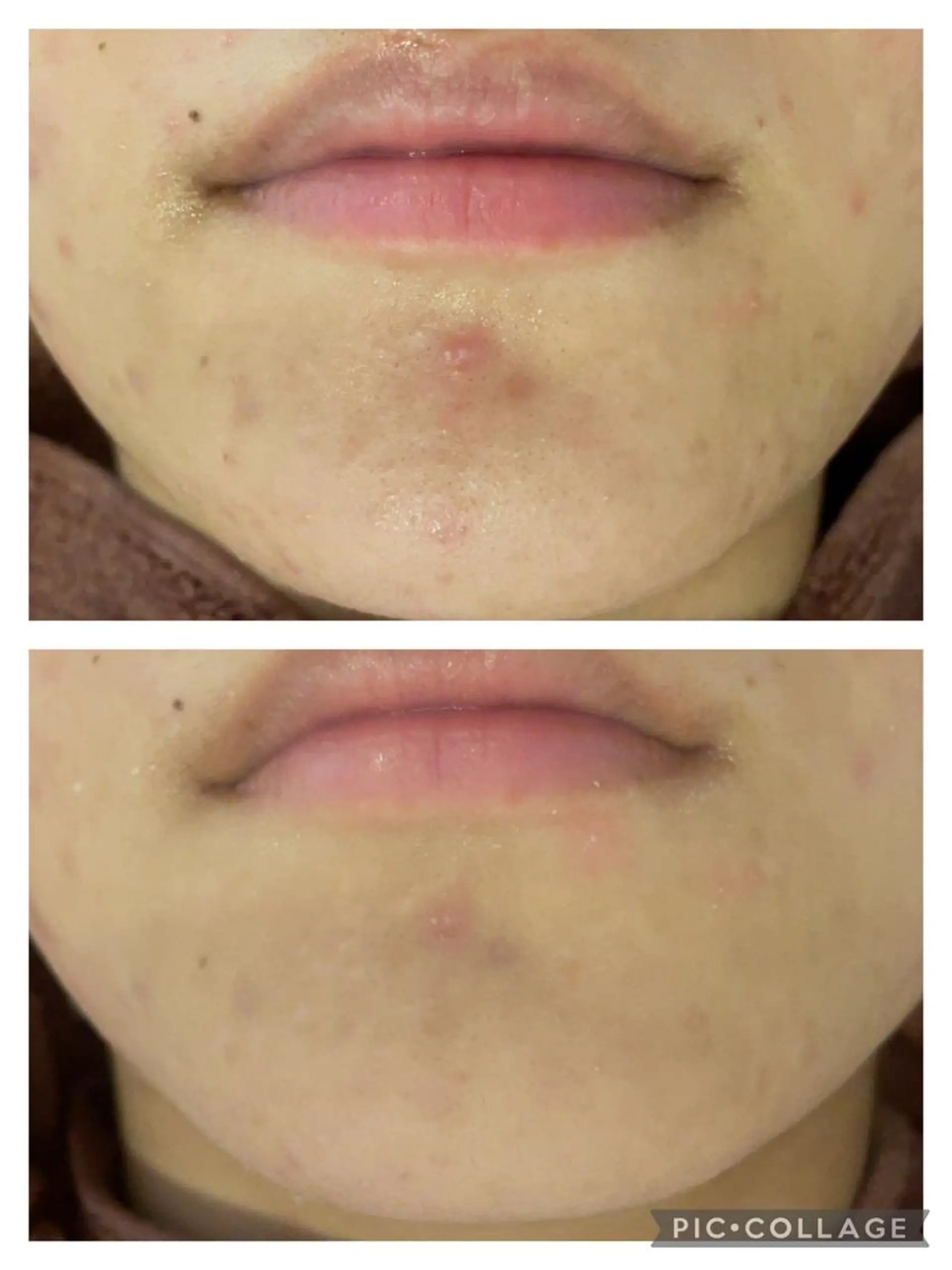 ショート カラー パーマ ヘアアレンジ メンズ キッズ ネイル マツエク・マツパ アイブロウ 3か月で肌革命👼 ニキビ専門店💫のエステ・リラクイメージ