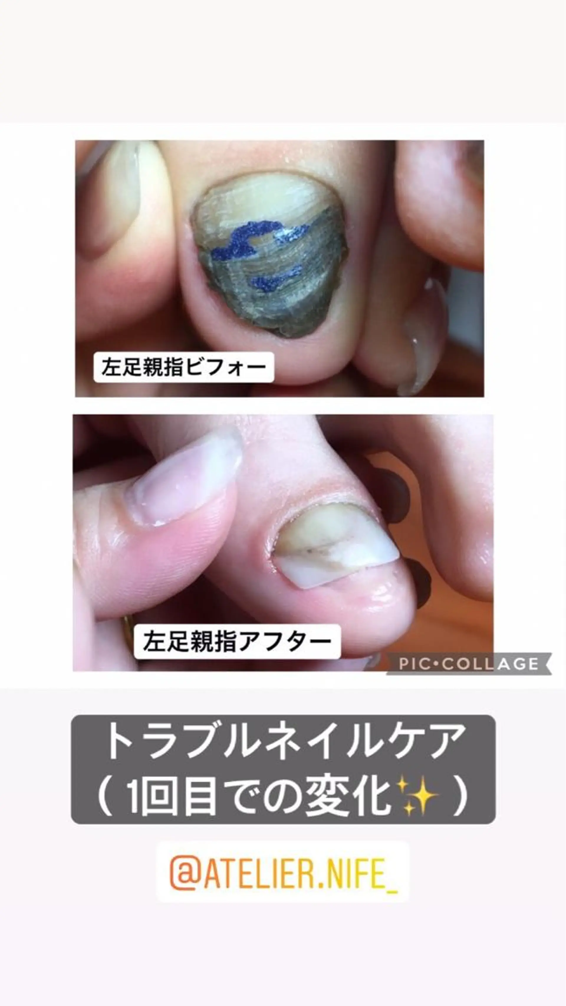 ネイル atelier nife.のネイルデザイン