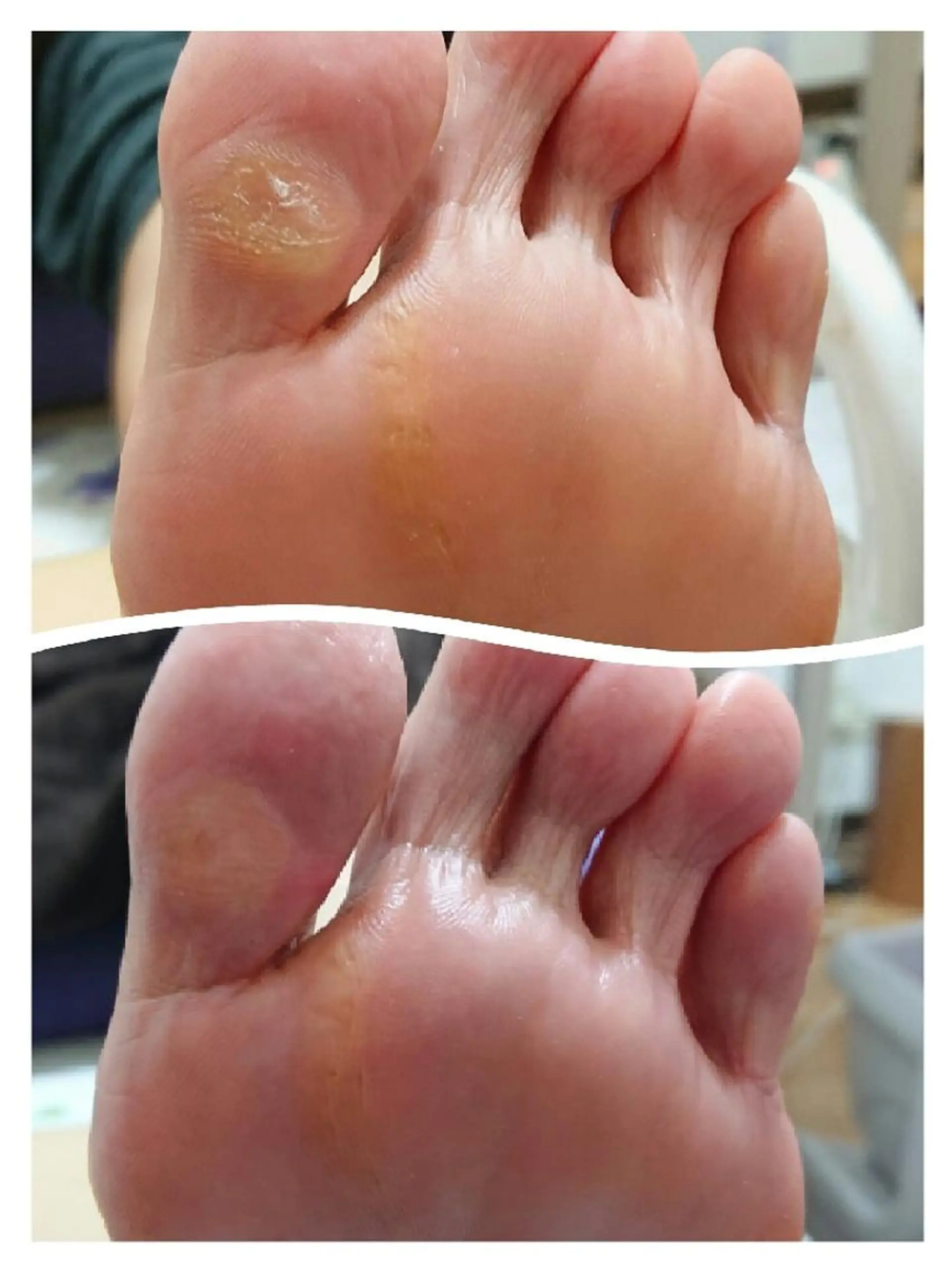 ネイル フットネイル あんきち    のネイルデザイン