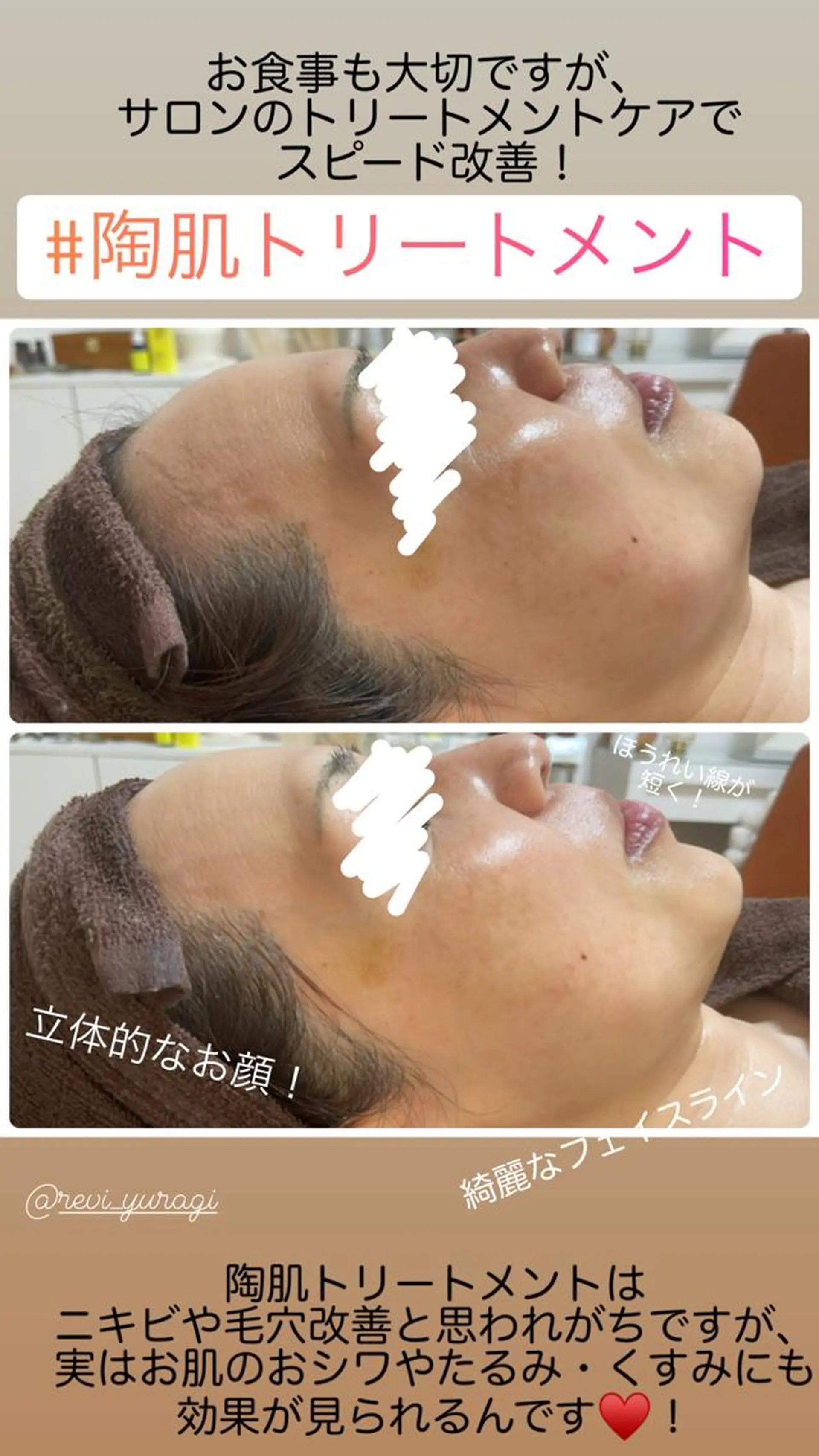 マツエク・マツパ アイブロウ エステ ニキビ・毛穴改善 🌿ハーブピーリングのエステ・リラクイメージ