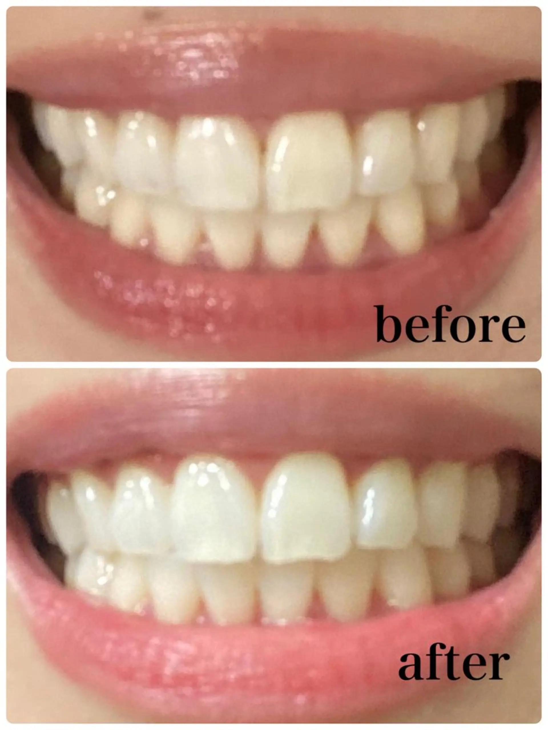 カラー メンズ その他 アモロッソ 🐻Miiのマツエク・マツパデザイン