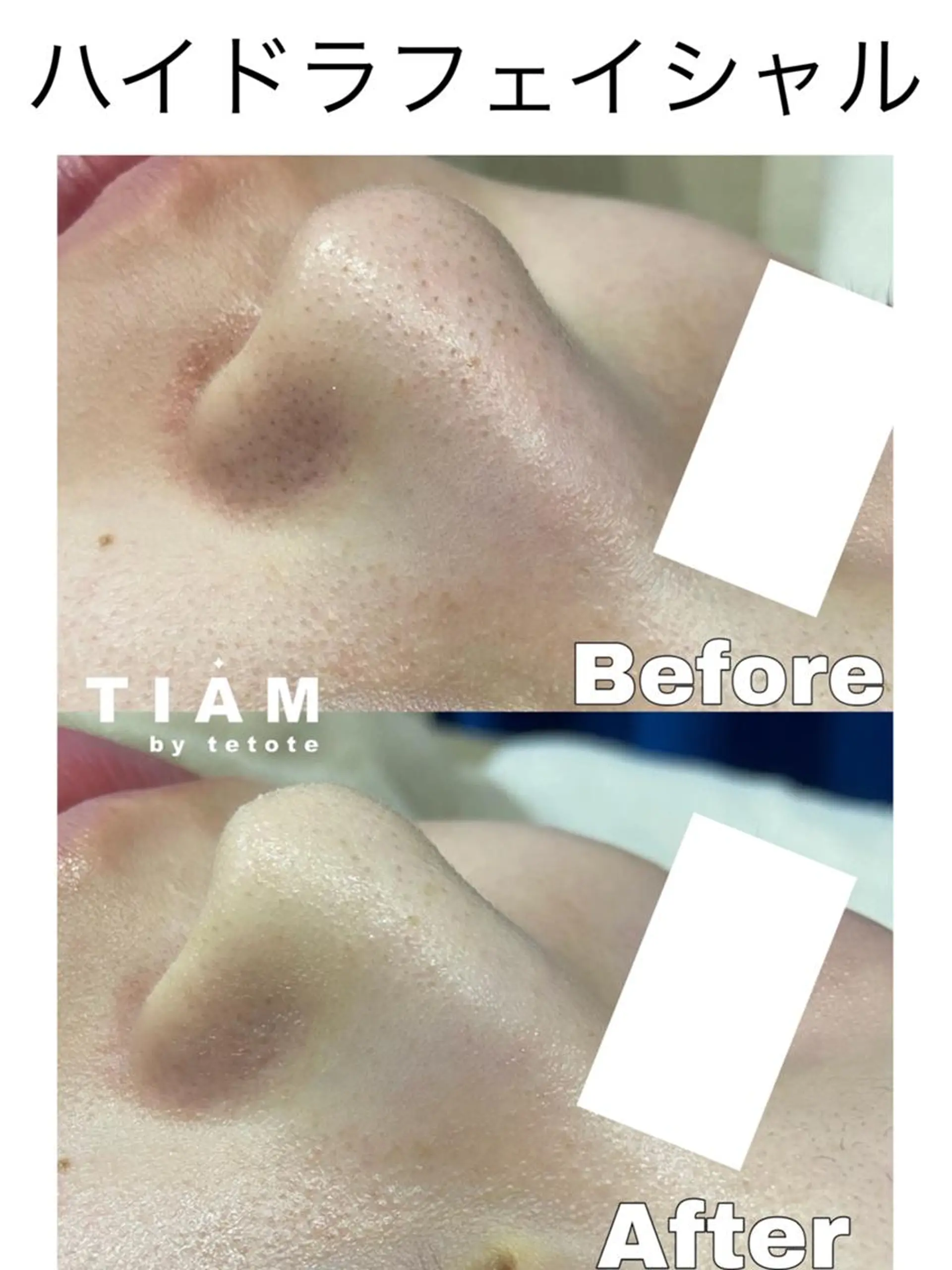 美肌サロンTIAM by tetoteのエステ・リラクイメージ