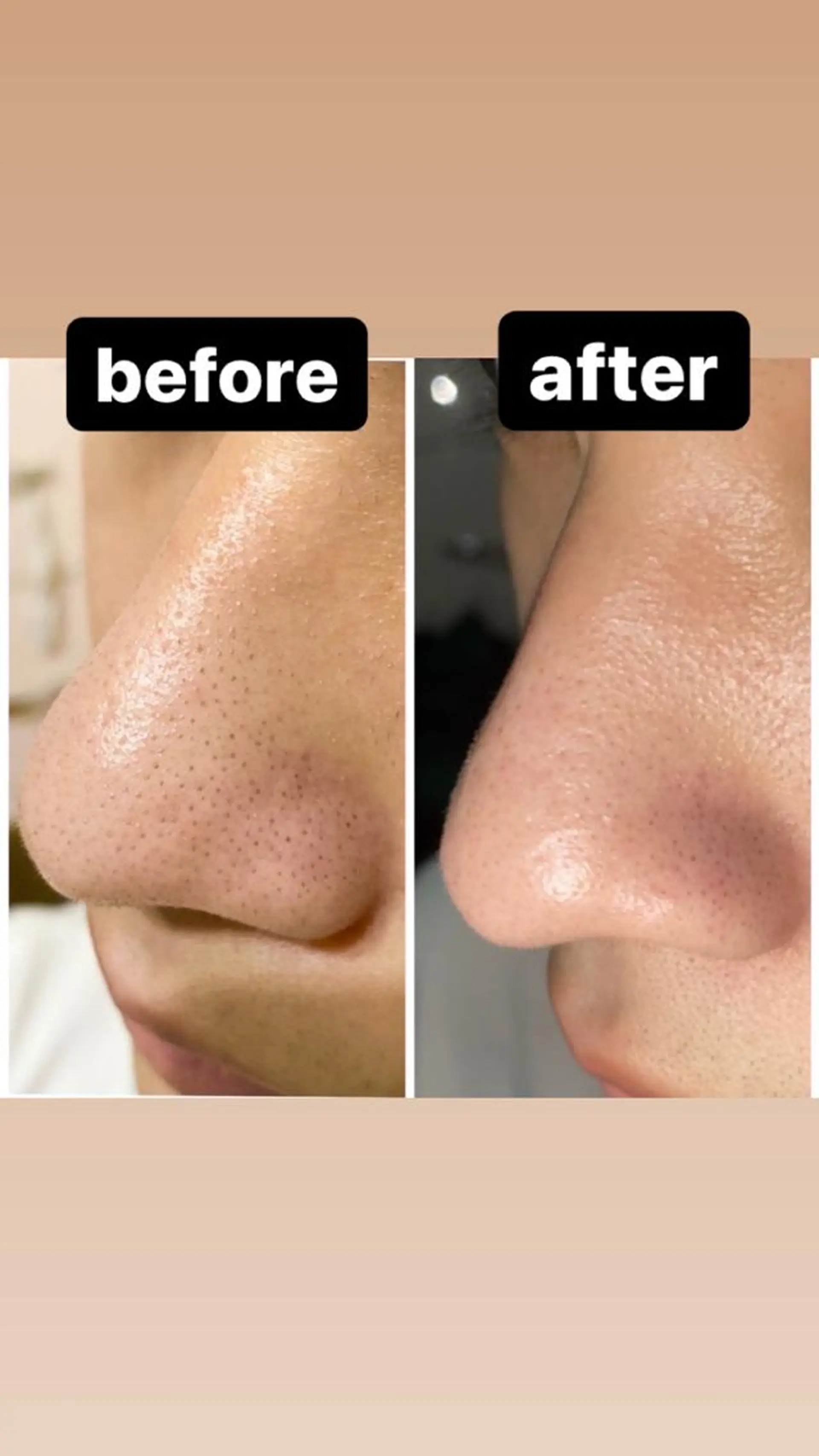 脱毛・エステサロン LuLuNのエステ・リラクイメージ