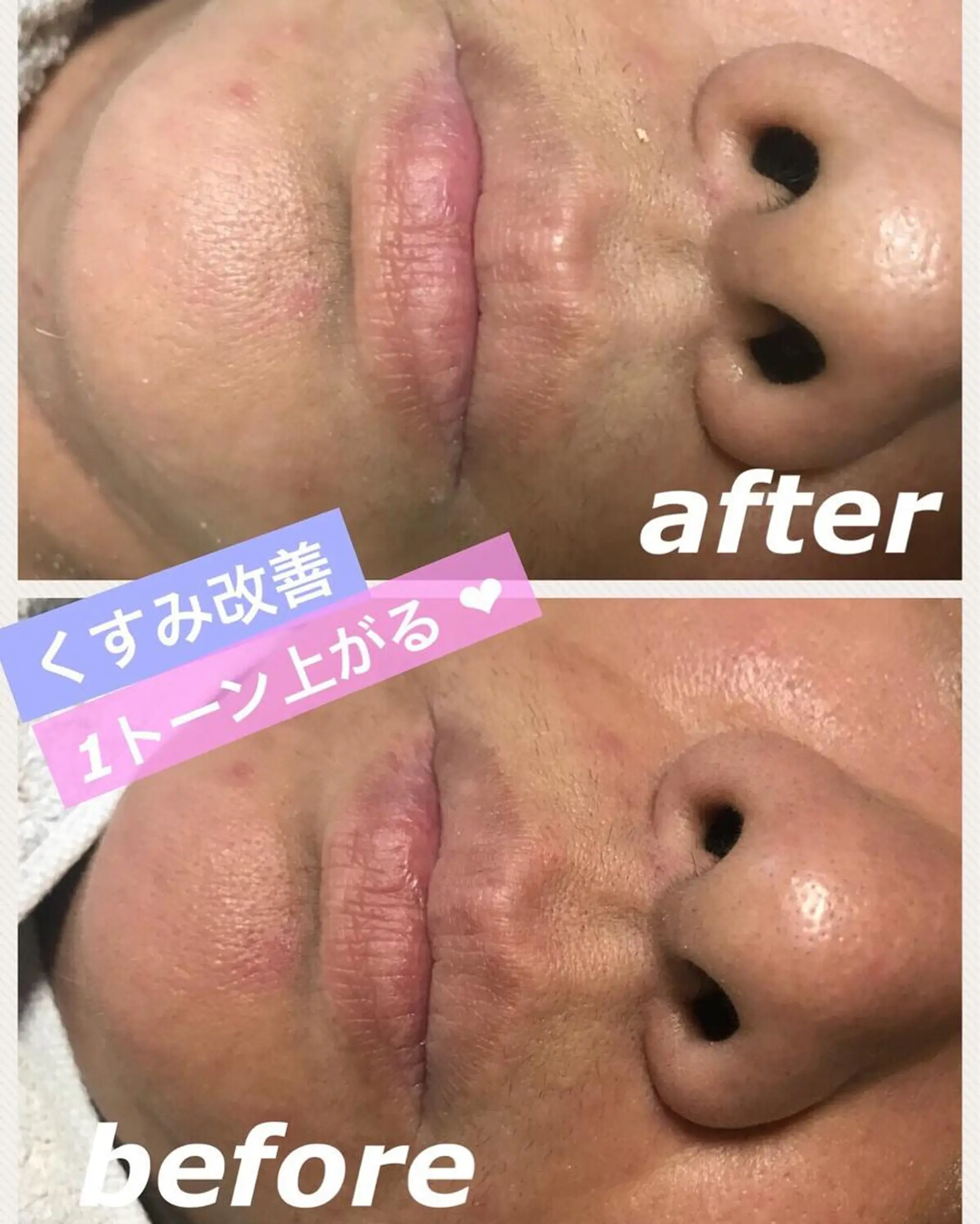 ミディアム カラー パーマ ヘアアレンジ メンズ キッズ ネイル マツエク・マツパ 金の糸脱毛 産毛ケア専門のエステ・リラクイメージ