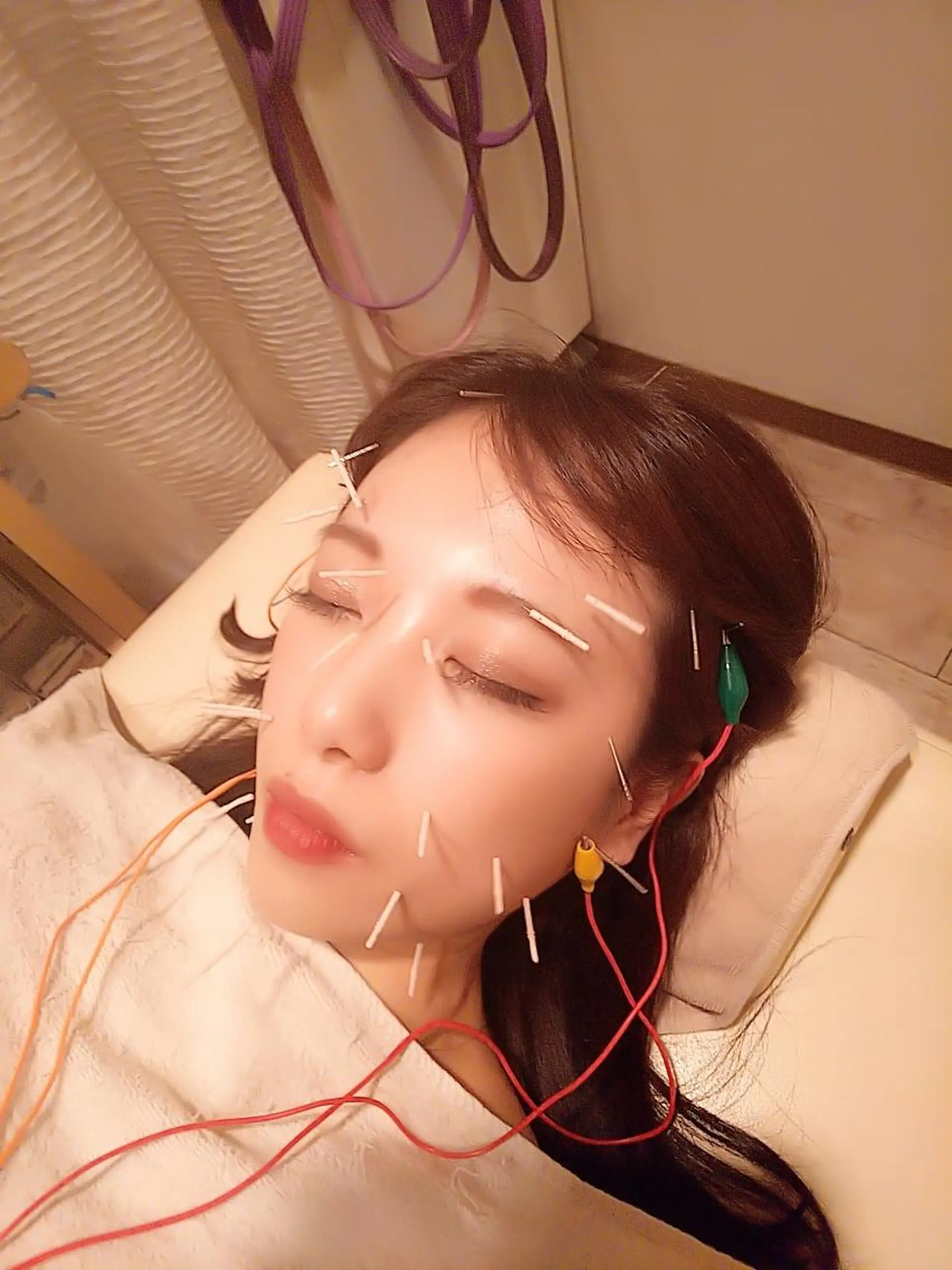 むくみたるみ専門☆ 美容鍼・小顔矯正のエステ・リラクイメージ