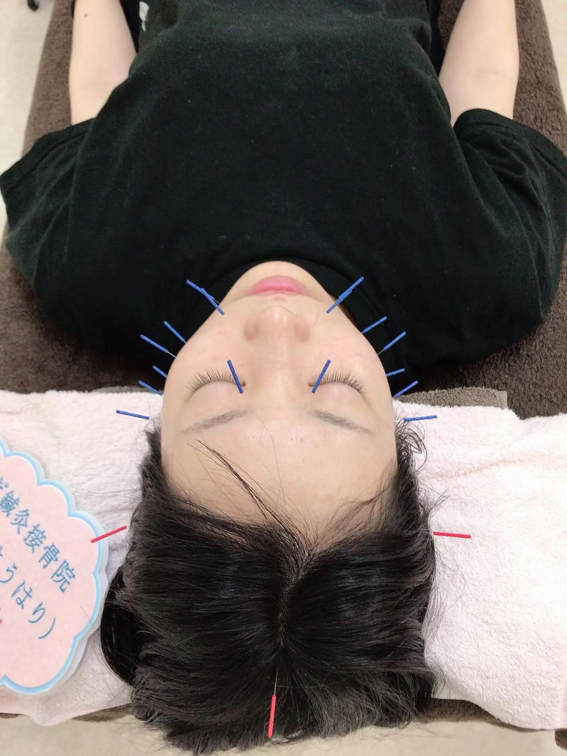 エステ リラク やまだ鍼灸接骨院（やまだしんきゅうせっこついん）所属・山田 晃のエステ・リラクイメージ