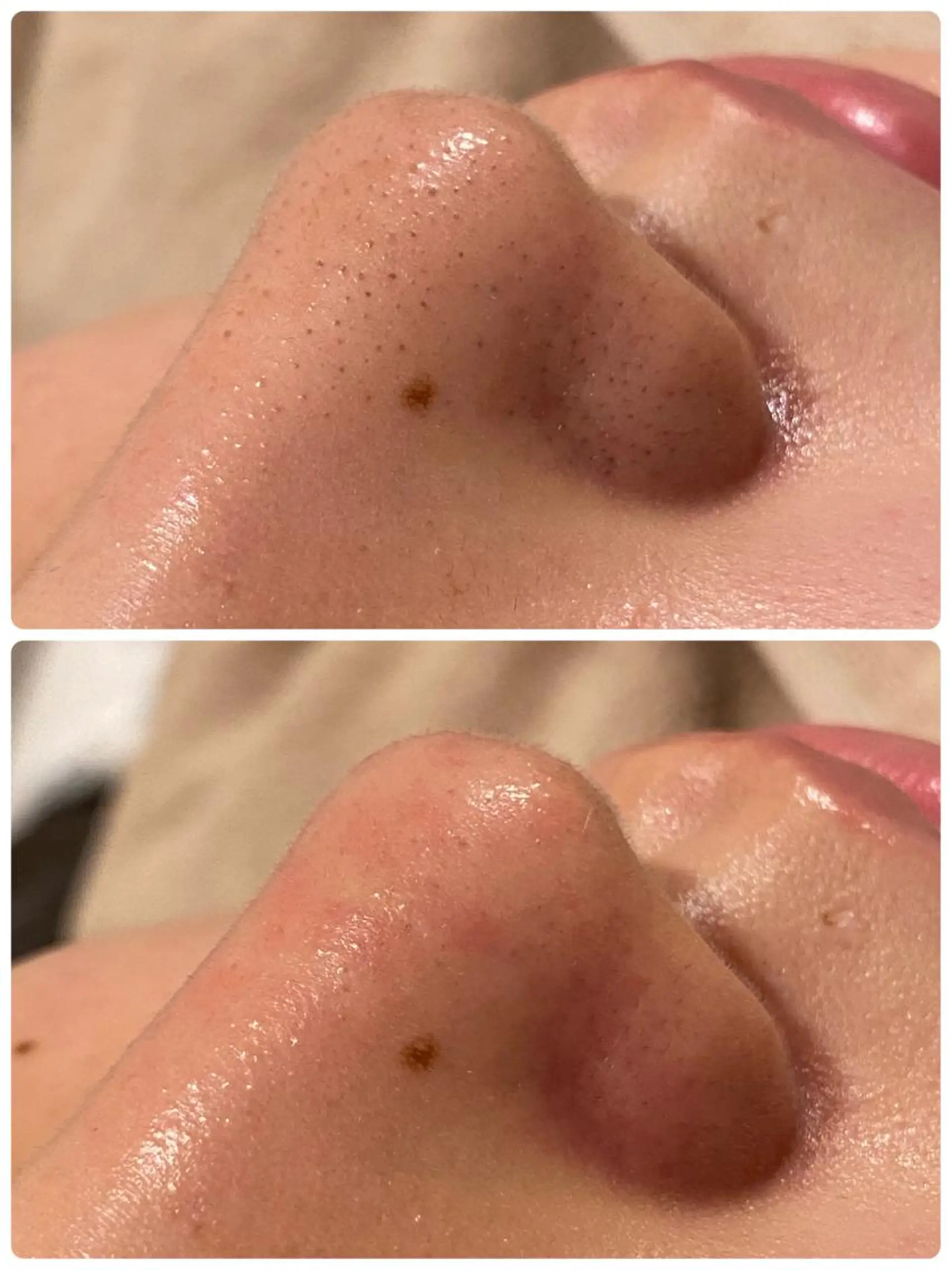 エステ LUKE （ルーク）のエステ・リラクイメージ