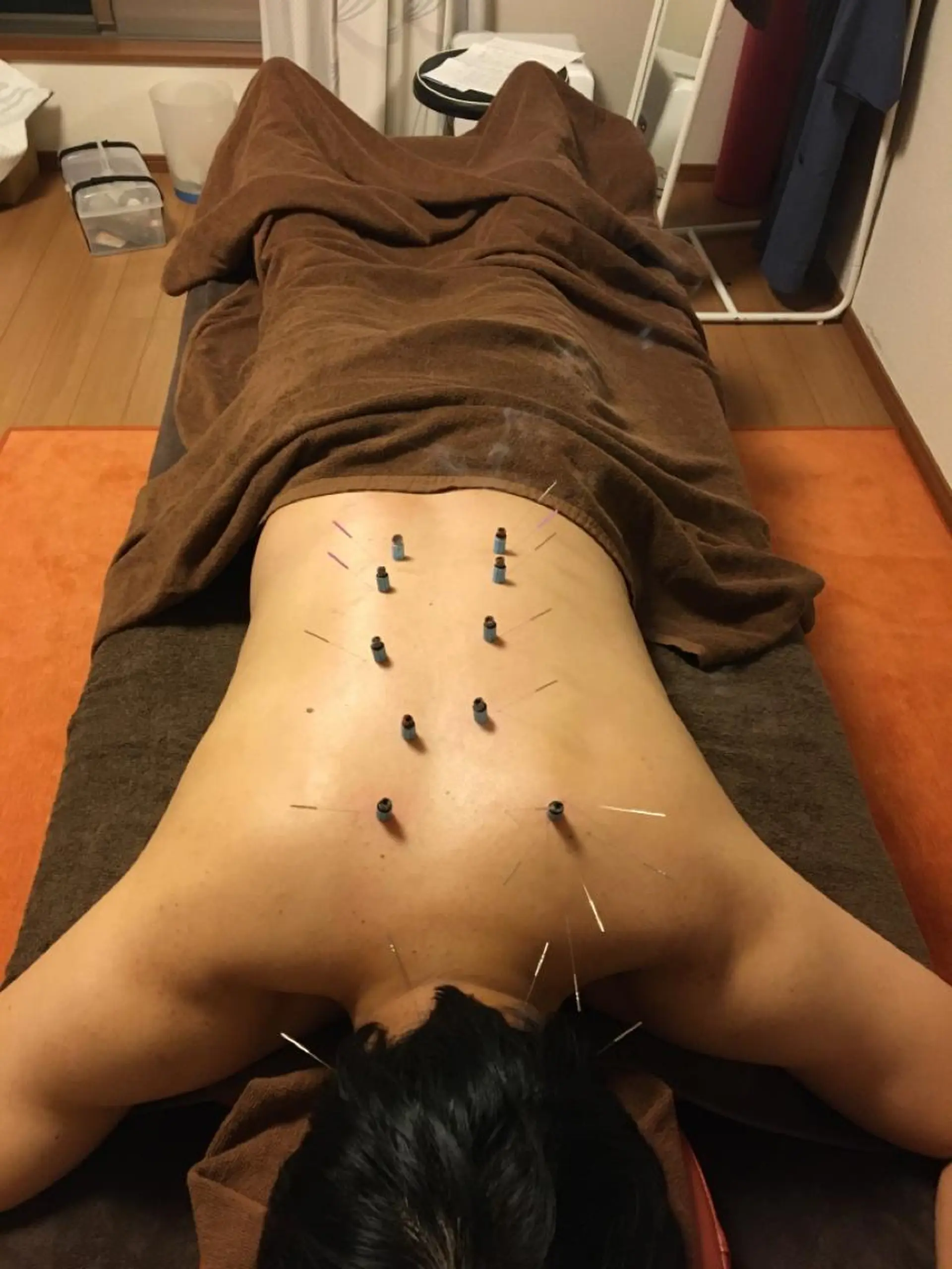 i鍼灸整体院所属・i鍼灸整体院 石井宏和のエステ・リラクイメージ