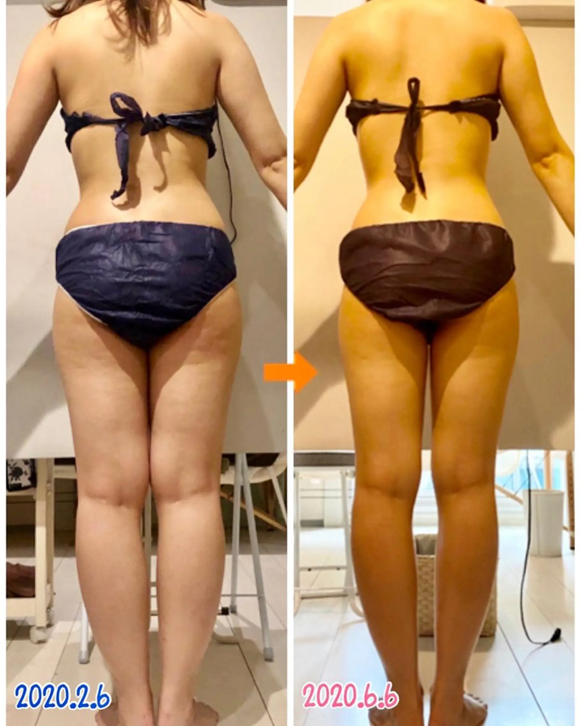 ショート カラー パーマ ヘアアレンジ メンズ キッズ ネイル マツエク・マツパ エステ リラク ‍痩身＆ボディ 結果出し🌟丹野のエステ・リラクイメージ