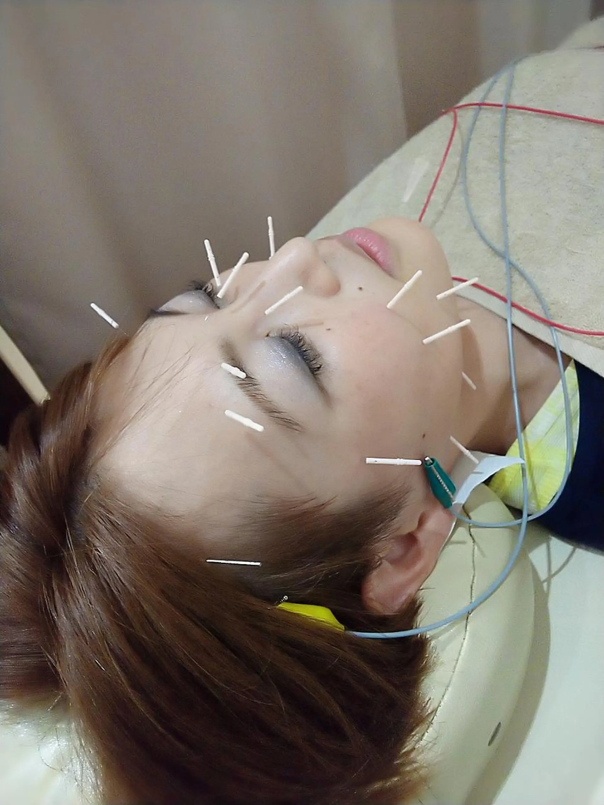 お顔のむくみたるみ 専門☆美容鍼小顔矯正のエステ・リラクイメージ