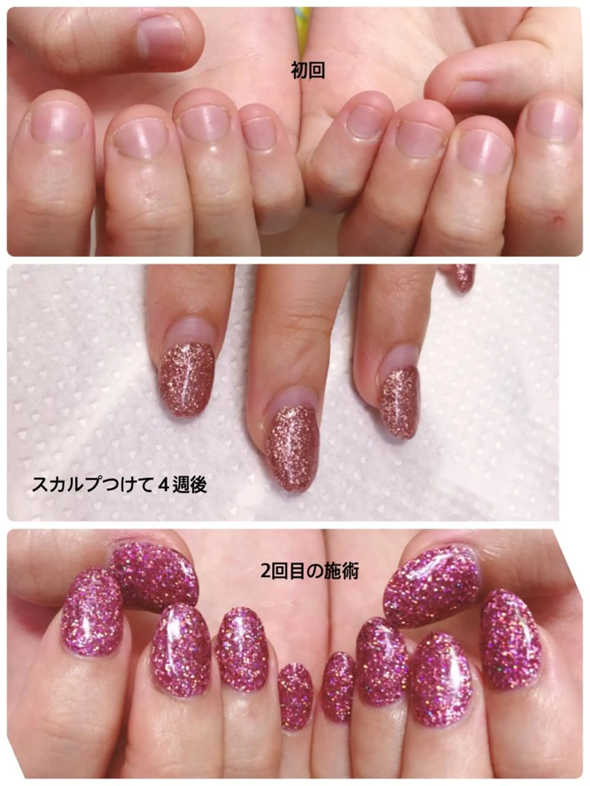 ネイル ハンドネイル 深爪を断らない スカルプ高評価店のネイルデザイン