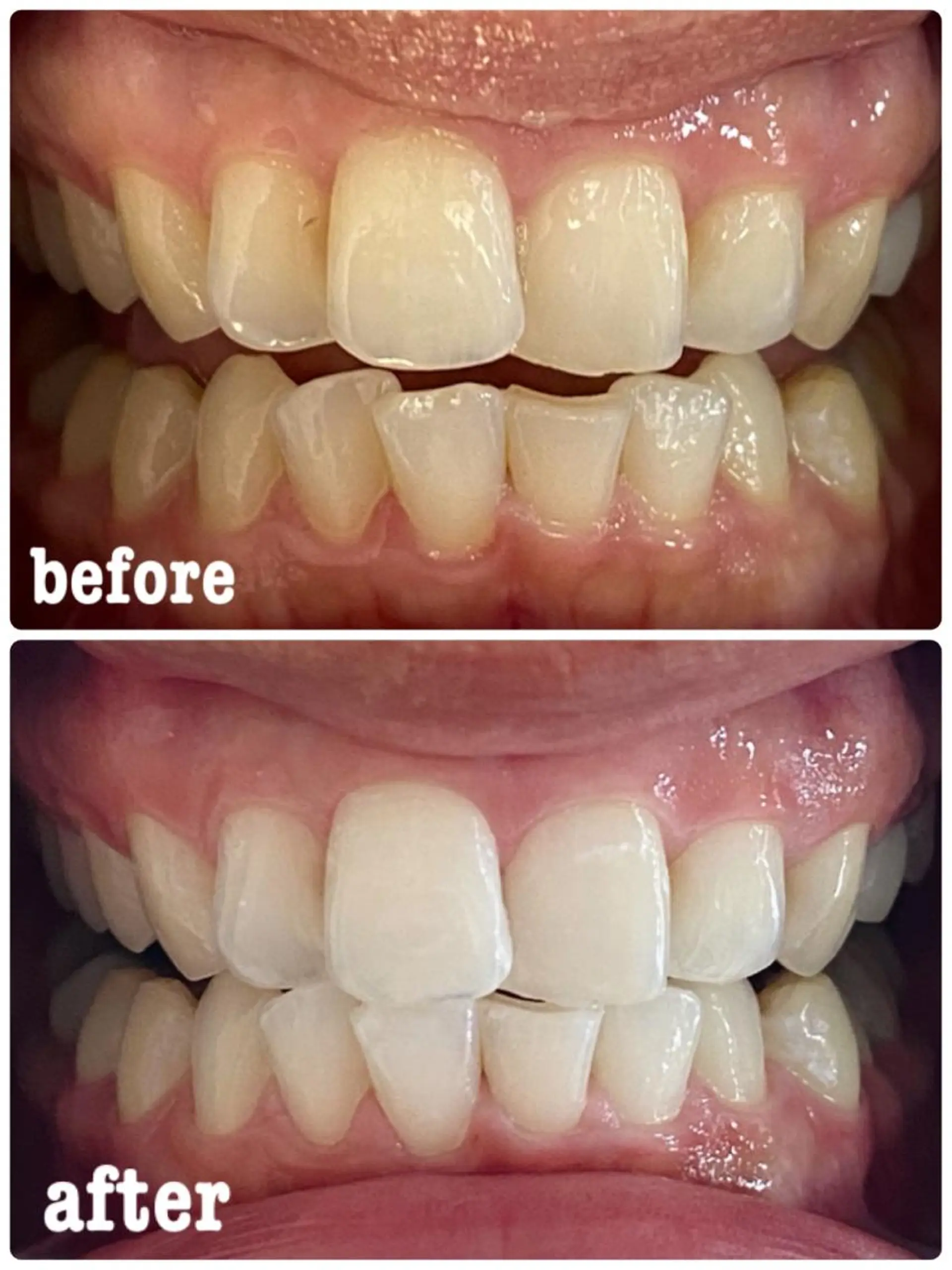 ホワイトニングサロン ラウレアのその他イメージ