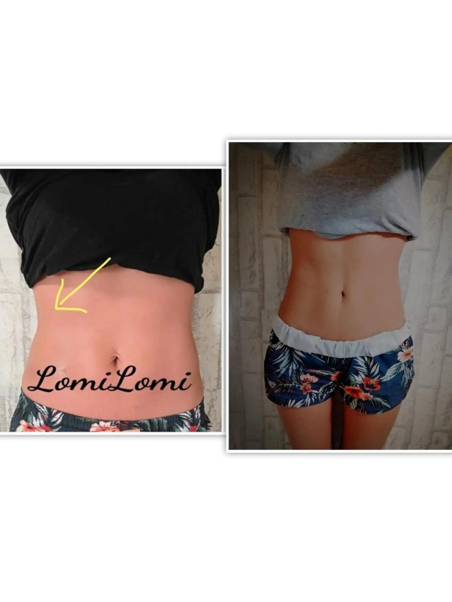 LOMILOMI Naoのエステ・リラクイメージ