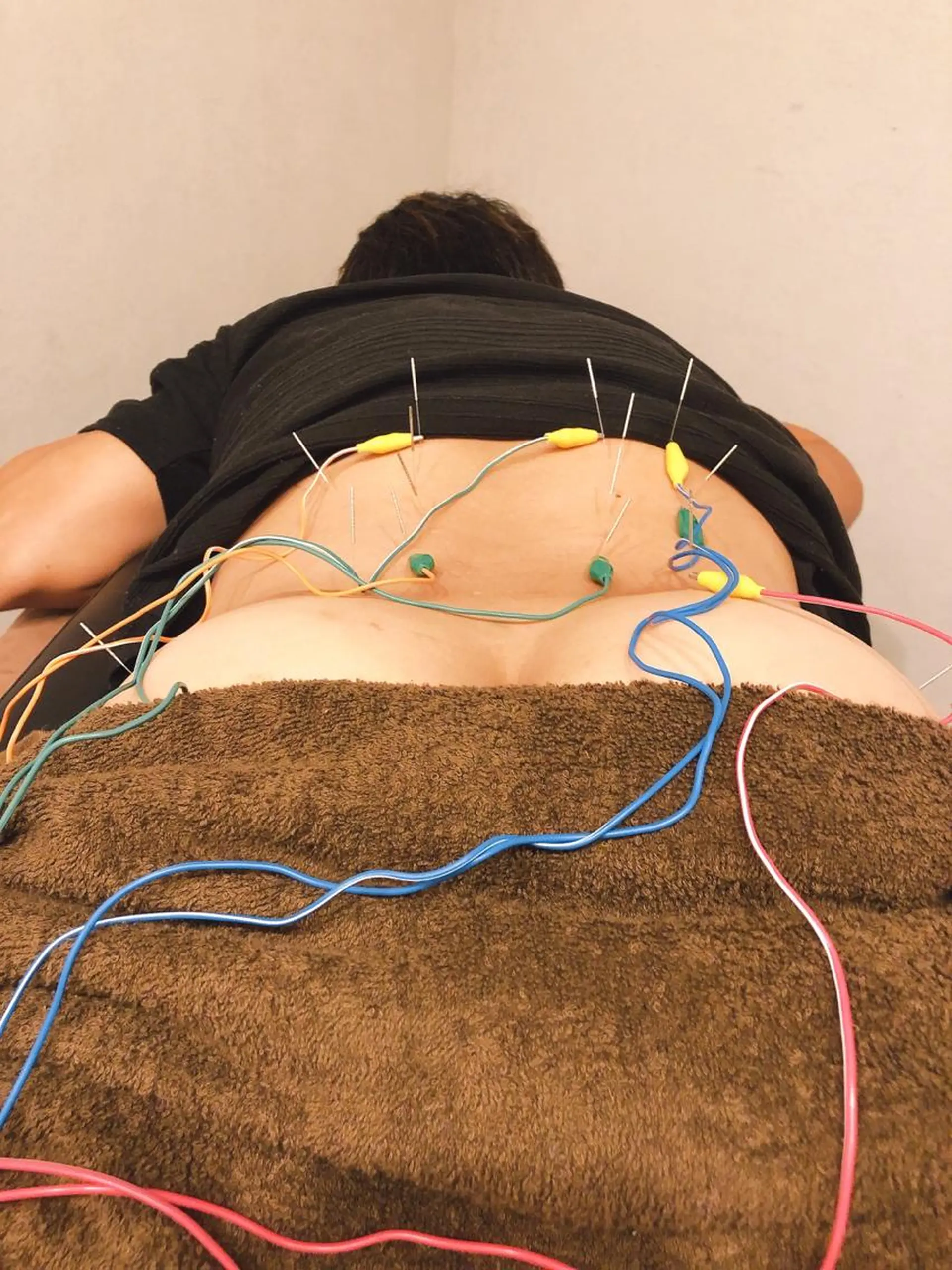 小顔矯/美容鍼/鍼灸 BeauJuのその他イメージ