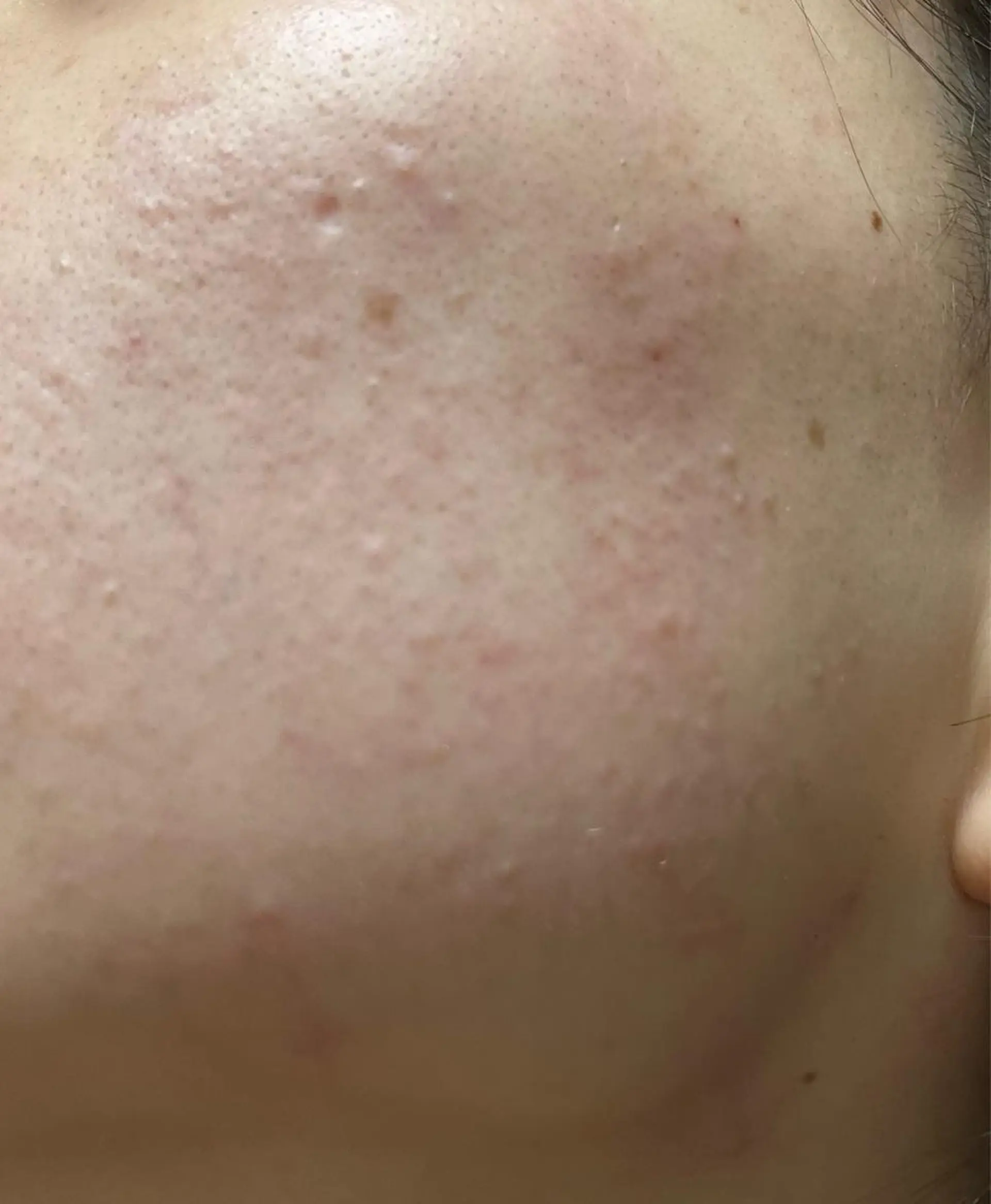 メンズ キッズ 脱毛 脱毛SALON RaYNiCKのエステ・リラクイメージ