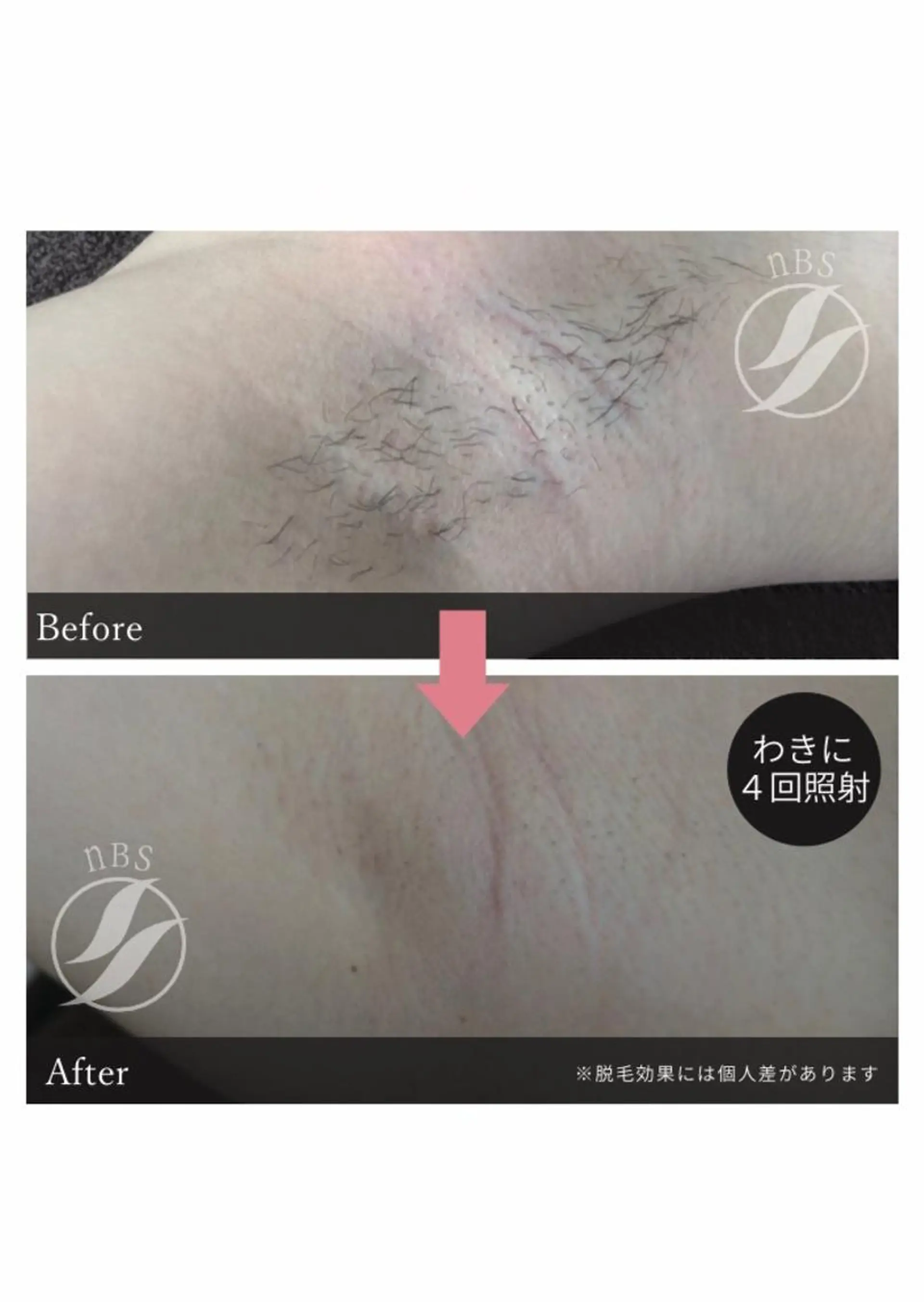 脱毛 Rene 慢性疲労ケアサロンのエステ・リラクイメージ