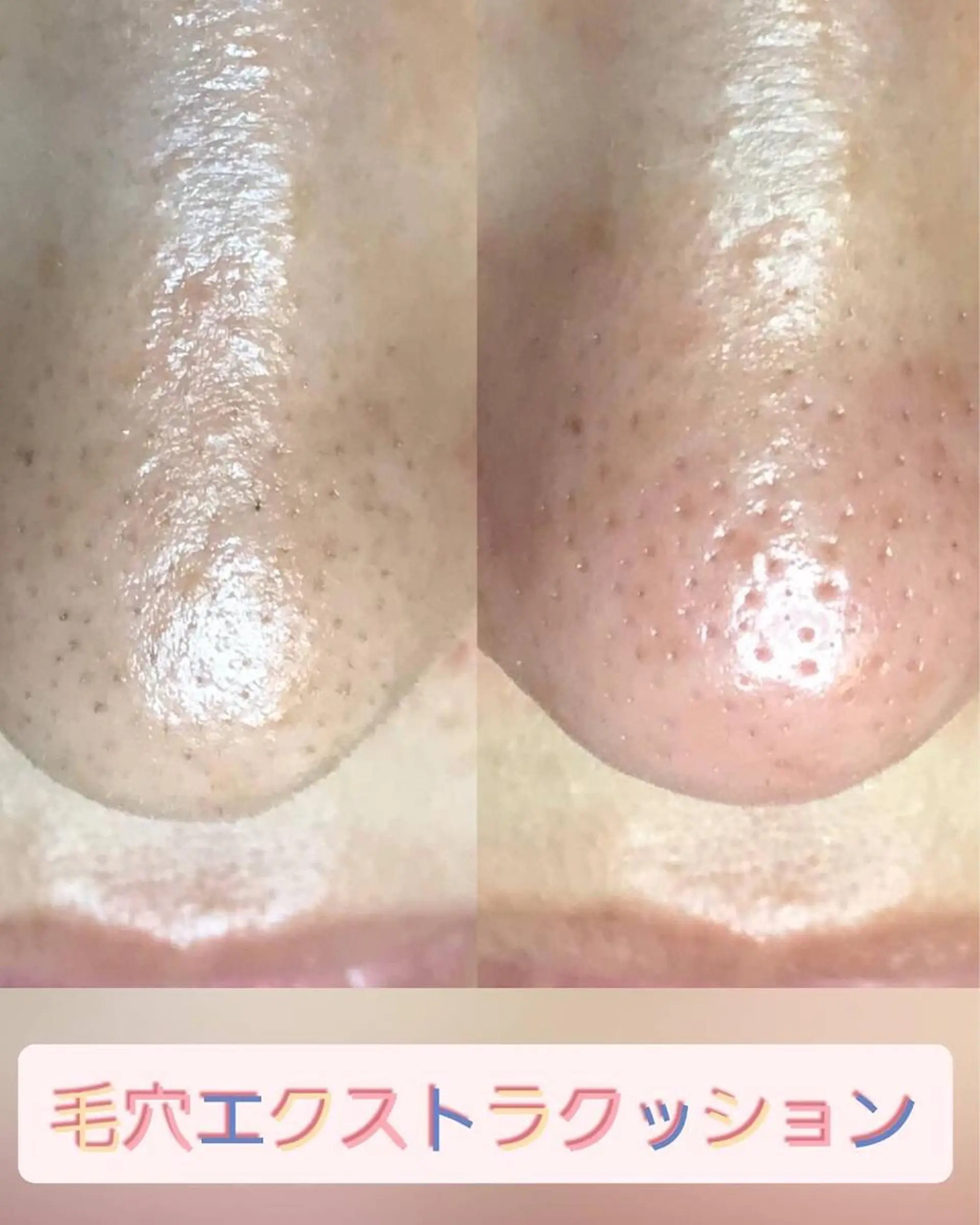 エステ Dione 立川店のエステ・リラクイメージ