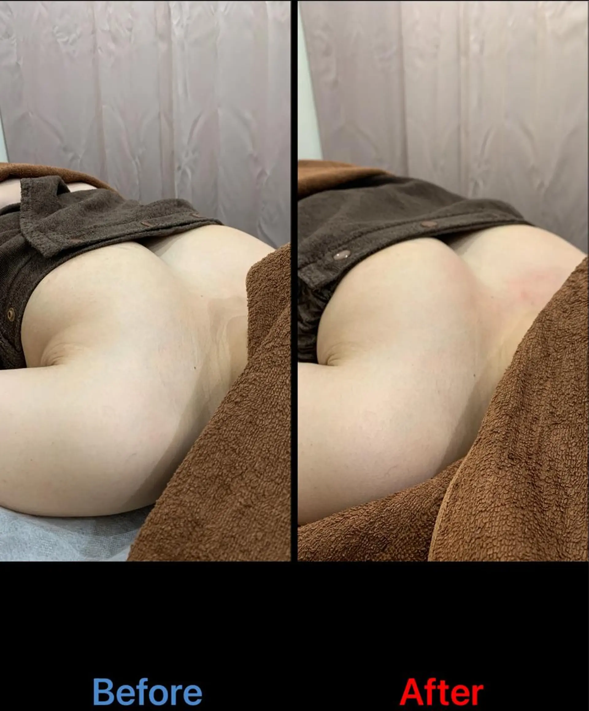 エステ 毛穴改善/脱毛 ネイル　川上久仁子のエステ・リラクイメージ