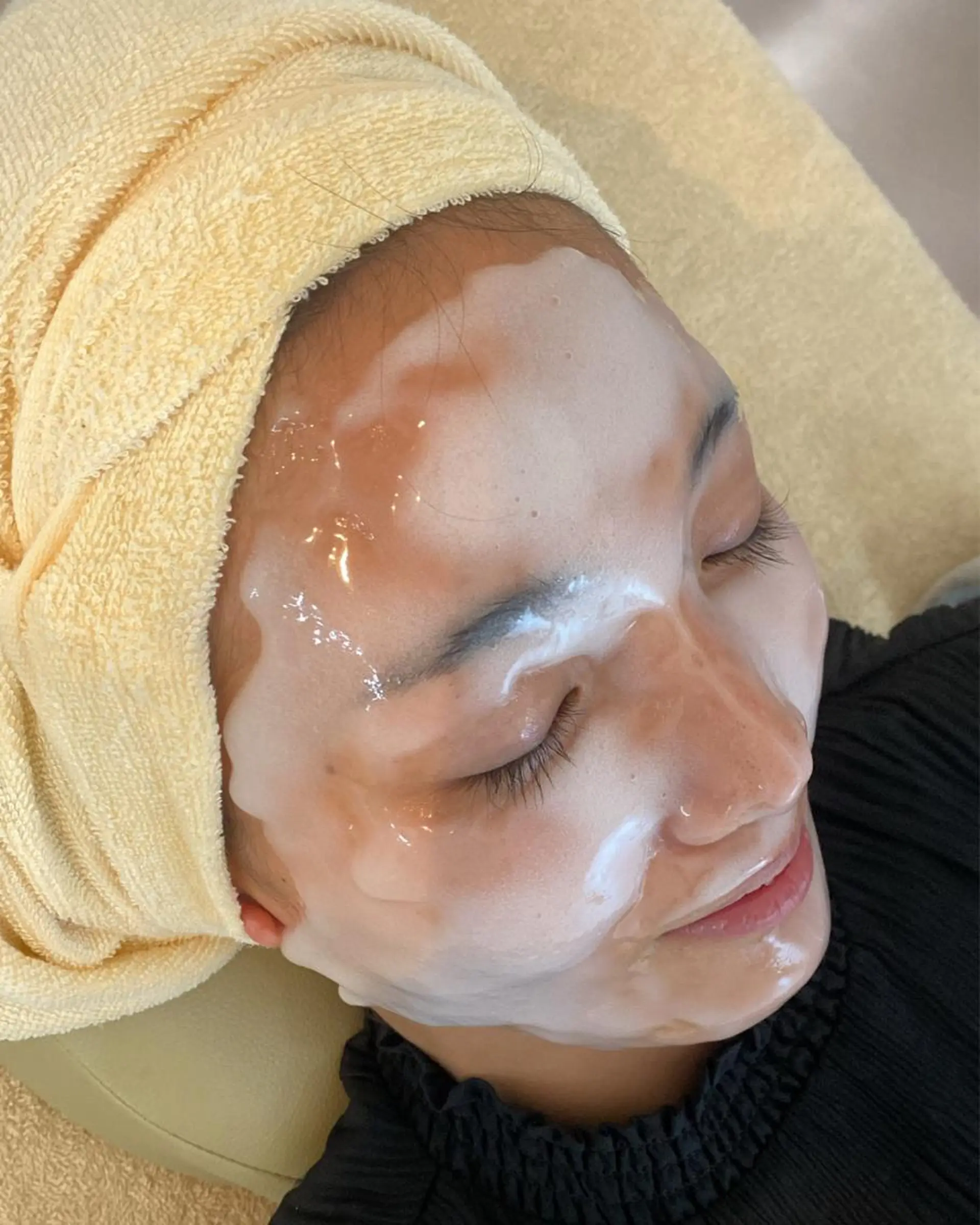 うなじ脱毛/美肌脱毛 LABELのエステ・リラクイメージ