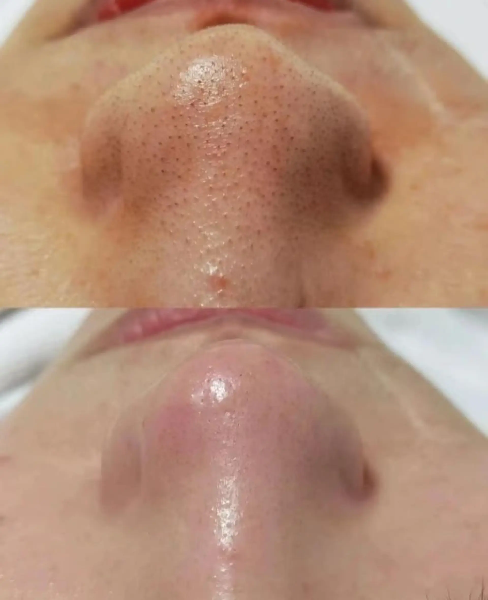 U・mi ユキのマツエク・マツパデザイン