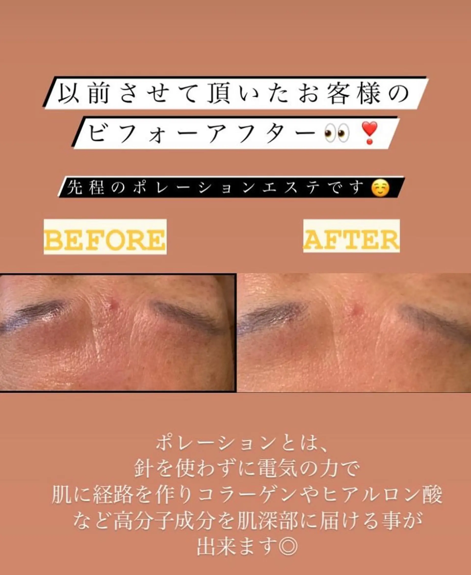 I. Ayaのエステ・リラクイメージ