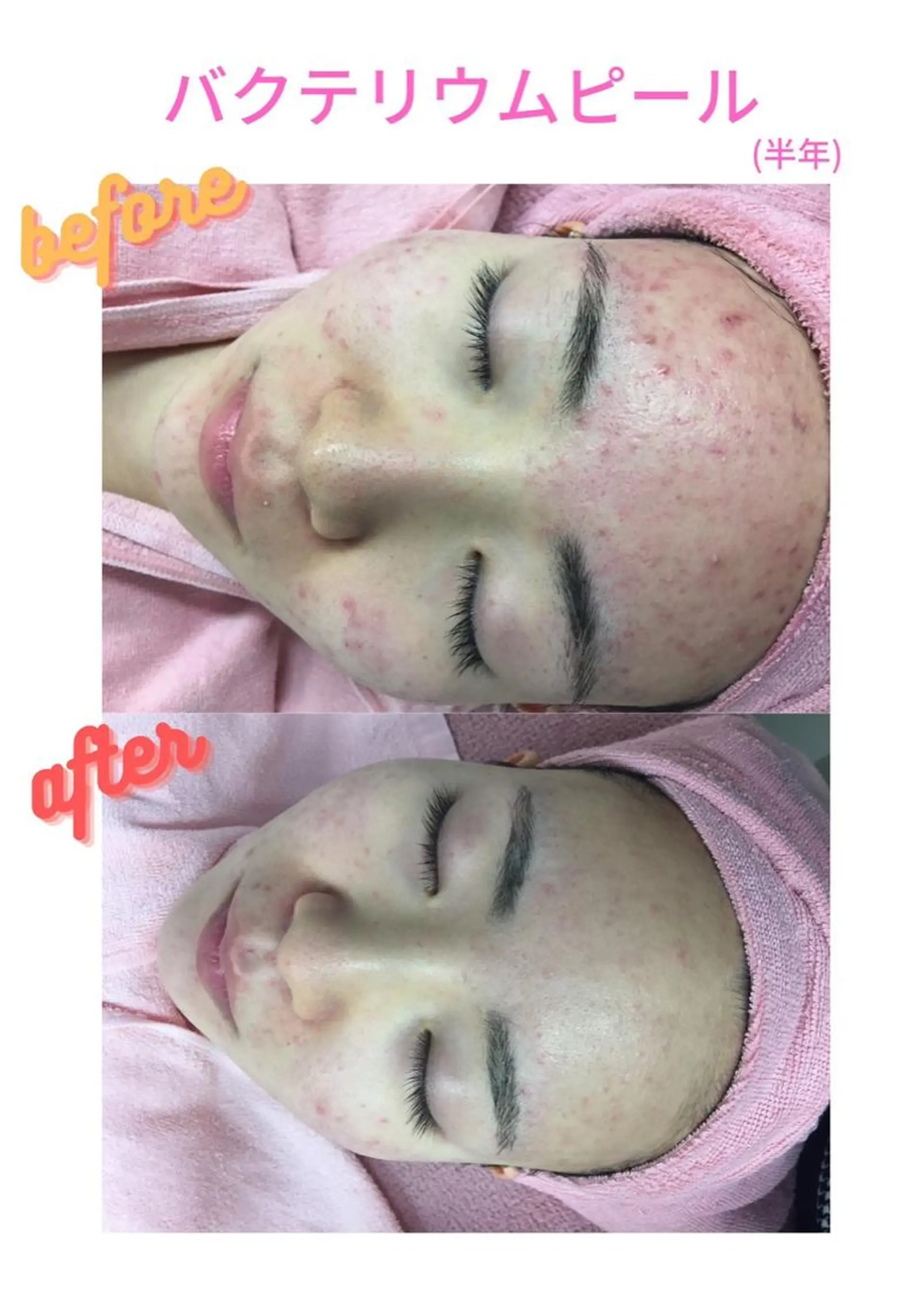 Linomalie エステ/たるみ/脱毛のエステ・リラクイメージ