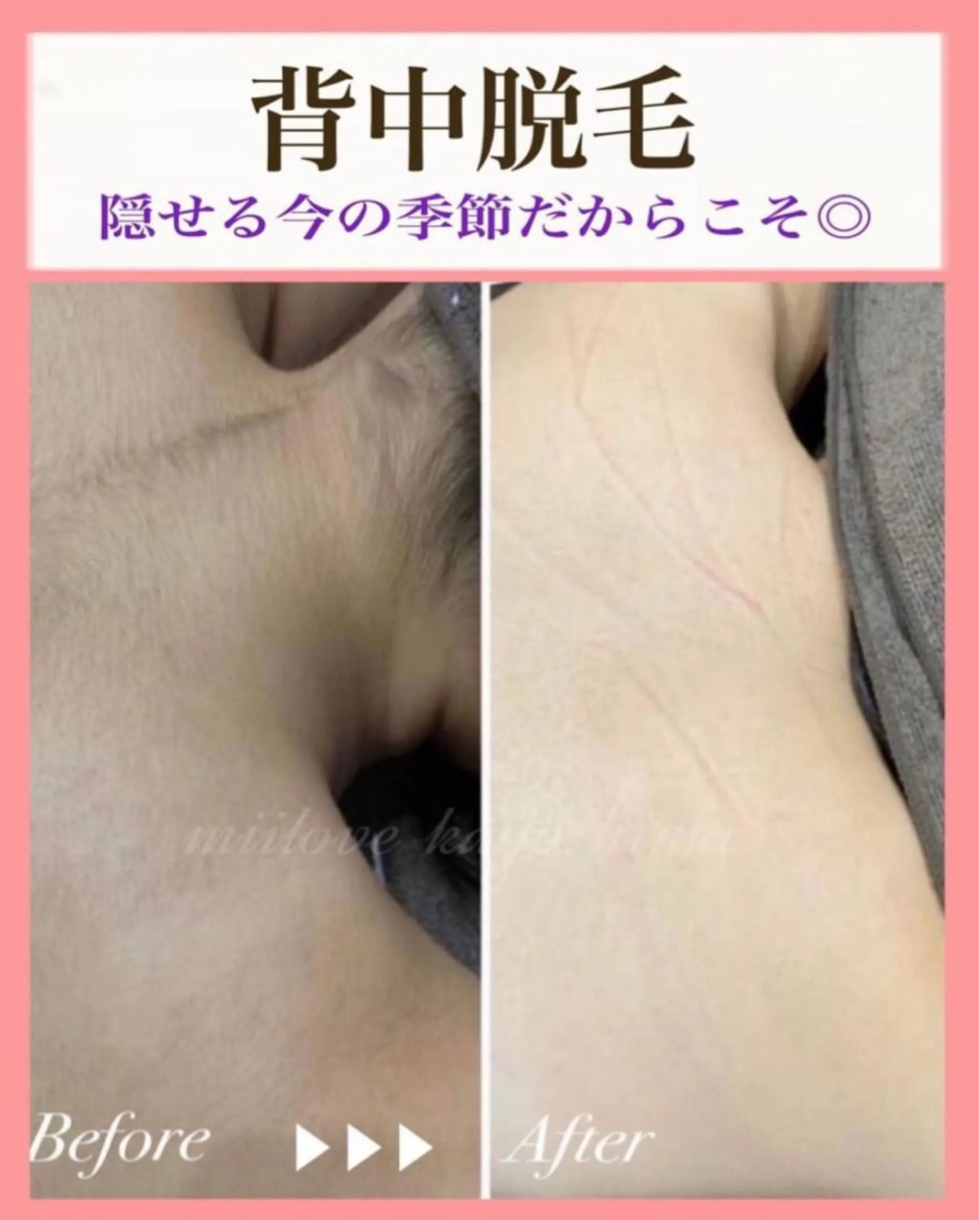 miilove 鹿児島店のエステ・リラクイメージ