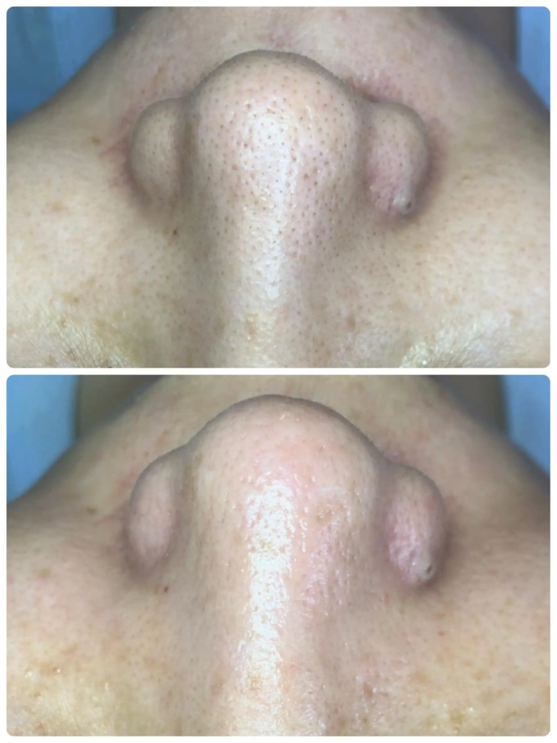 ピーリング専門サロン Spicaのエステ・リラクイメージ