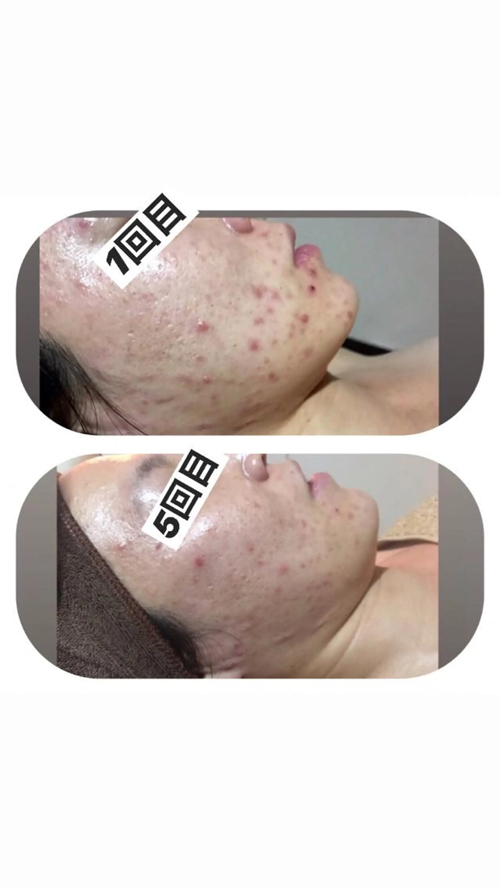 エステ 【足圧】鬼👹リンパ 身体整うサロンのエステ・リラクイメージ