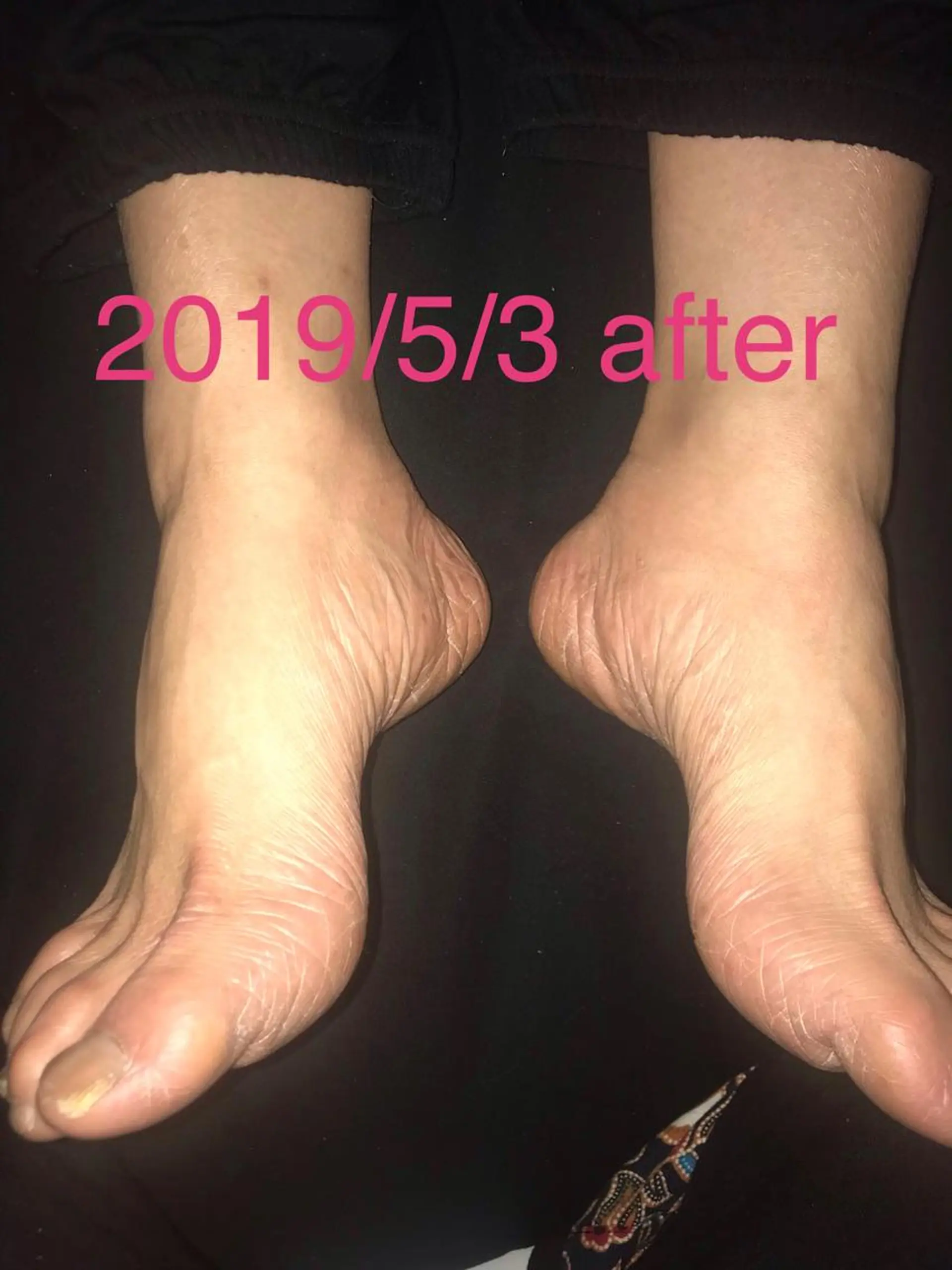 リラク 【足圧】鬼👹リンパ 身体整うサロンのエステ・リラクイメージ