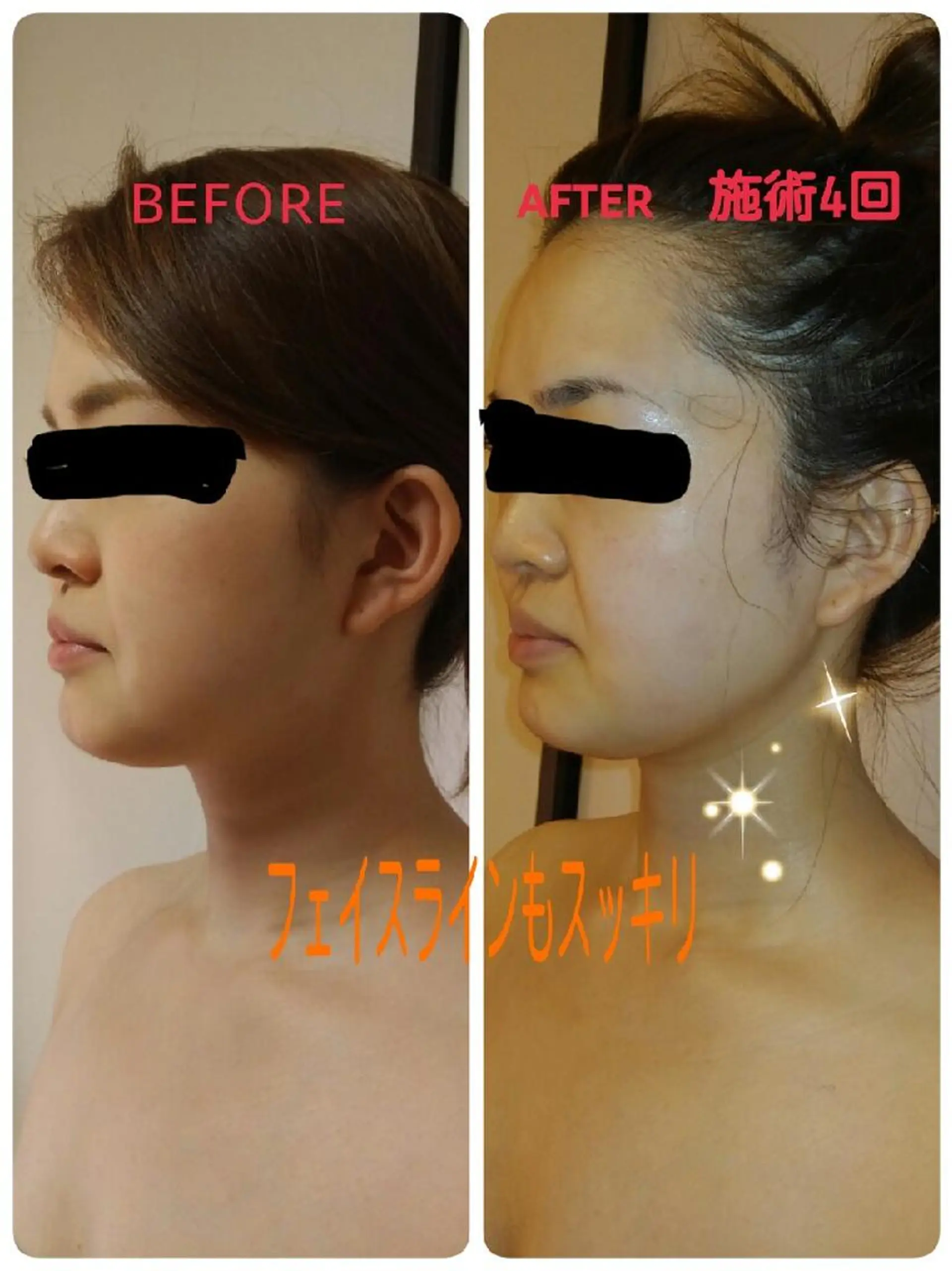 リンパサロン レディ ワンのエステ・リラクイメージ