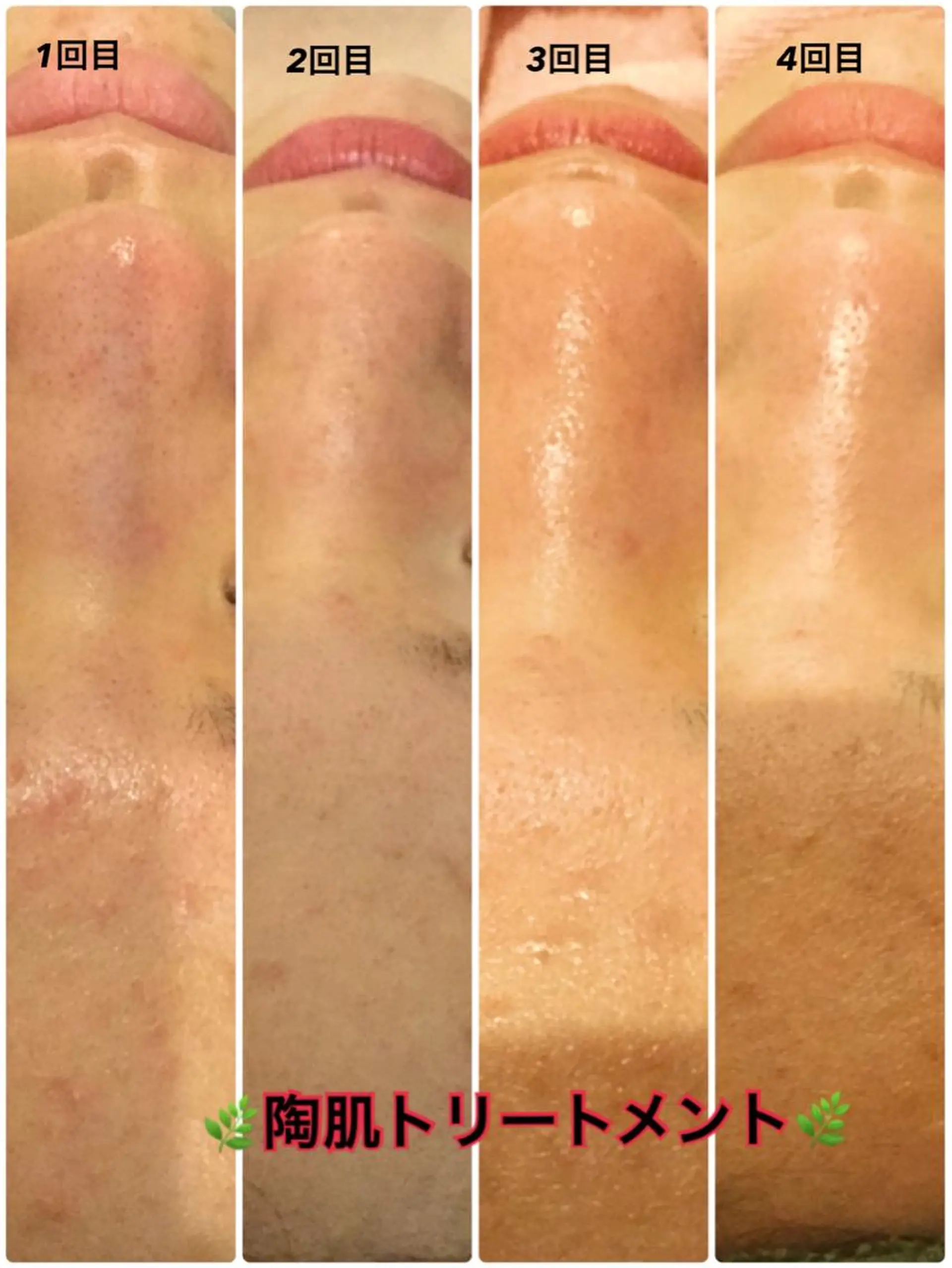 エステ Dione 立川店のエステ・リラクイメージ