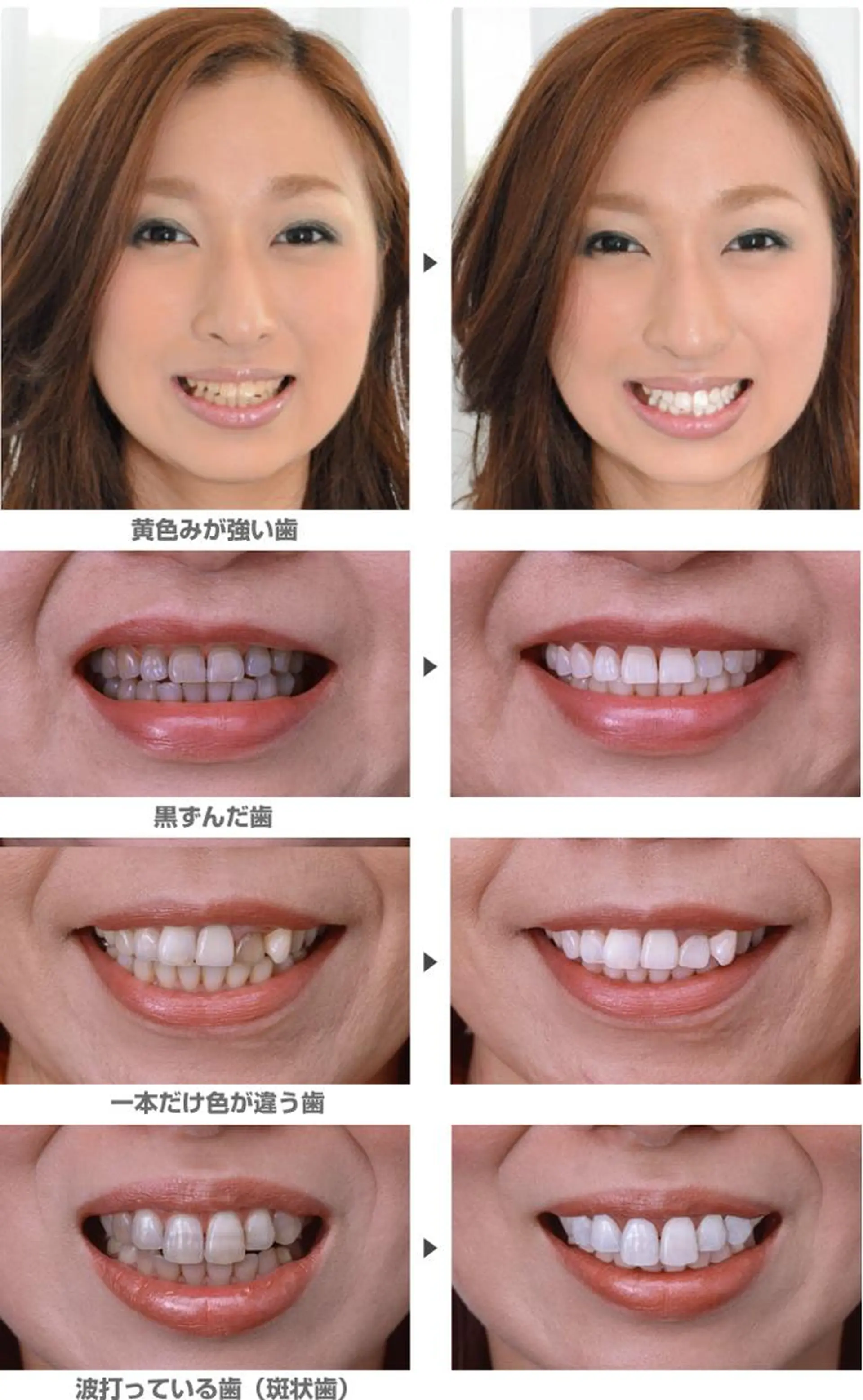 その他 DIA WHITE 奥田のその他イメージ