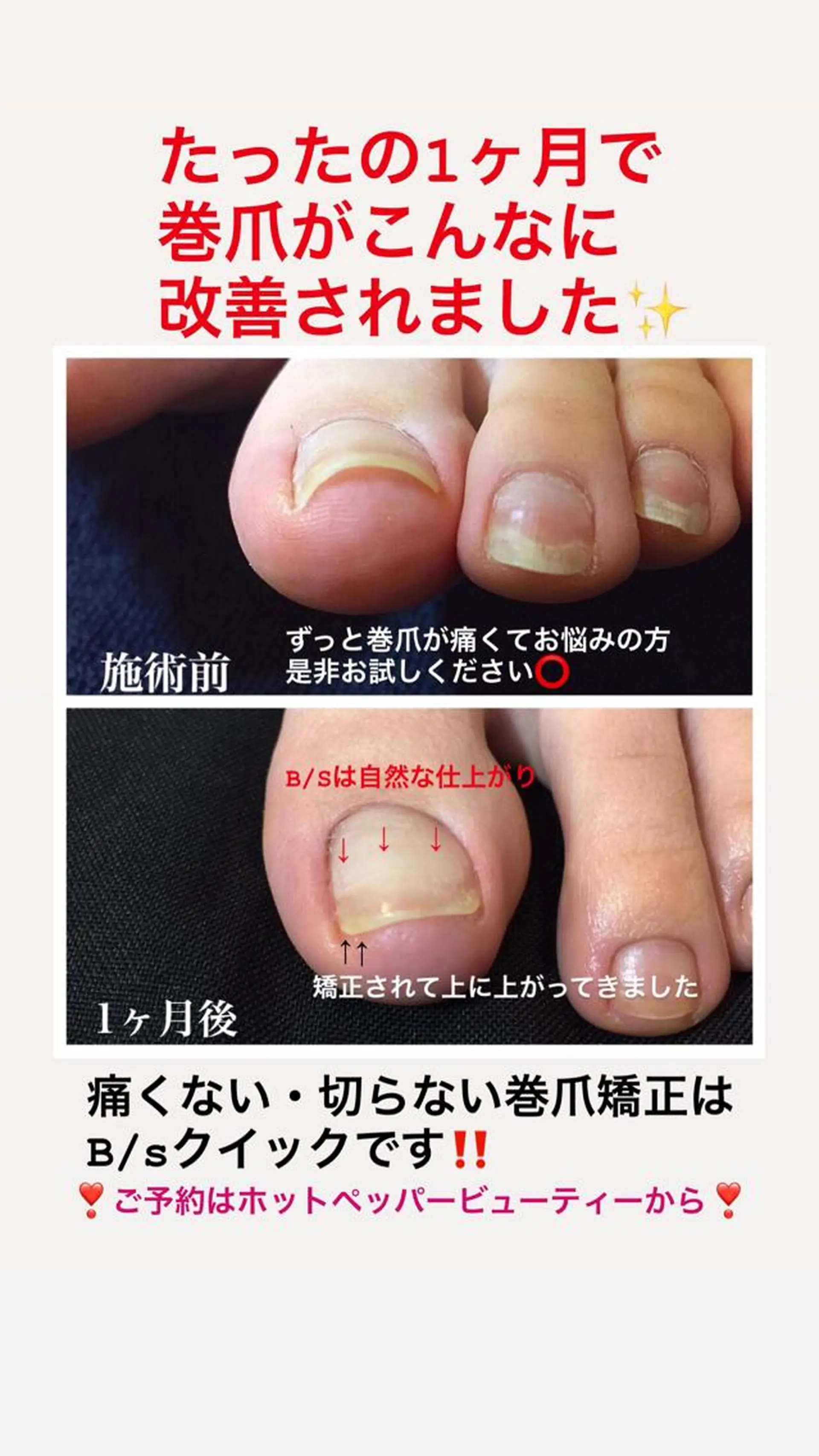 ネイル Viseo《6週間 長持ちパラジェル》のネイルデザイン