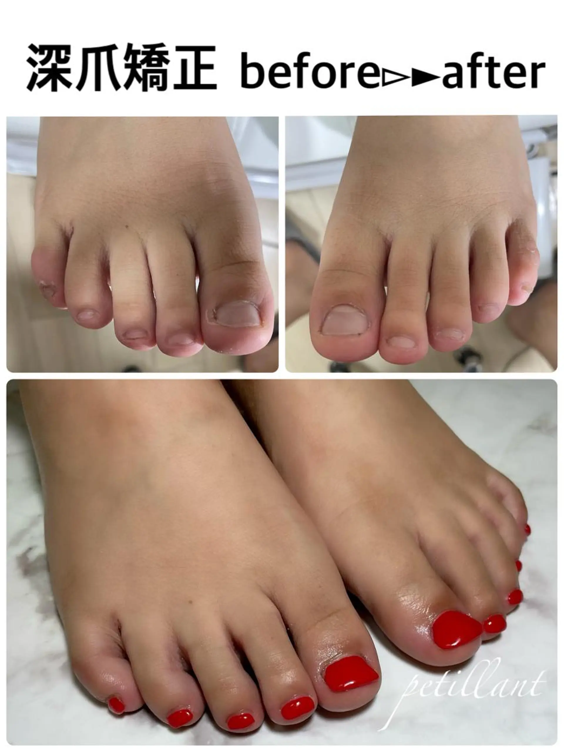 ネイル フットネイル 赤色 スクエアネイル nail salon petillantのネイルデザイン