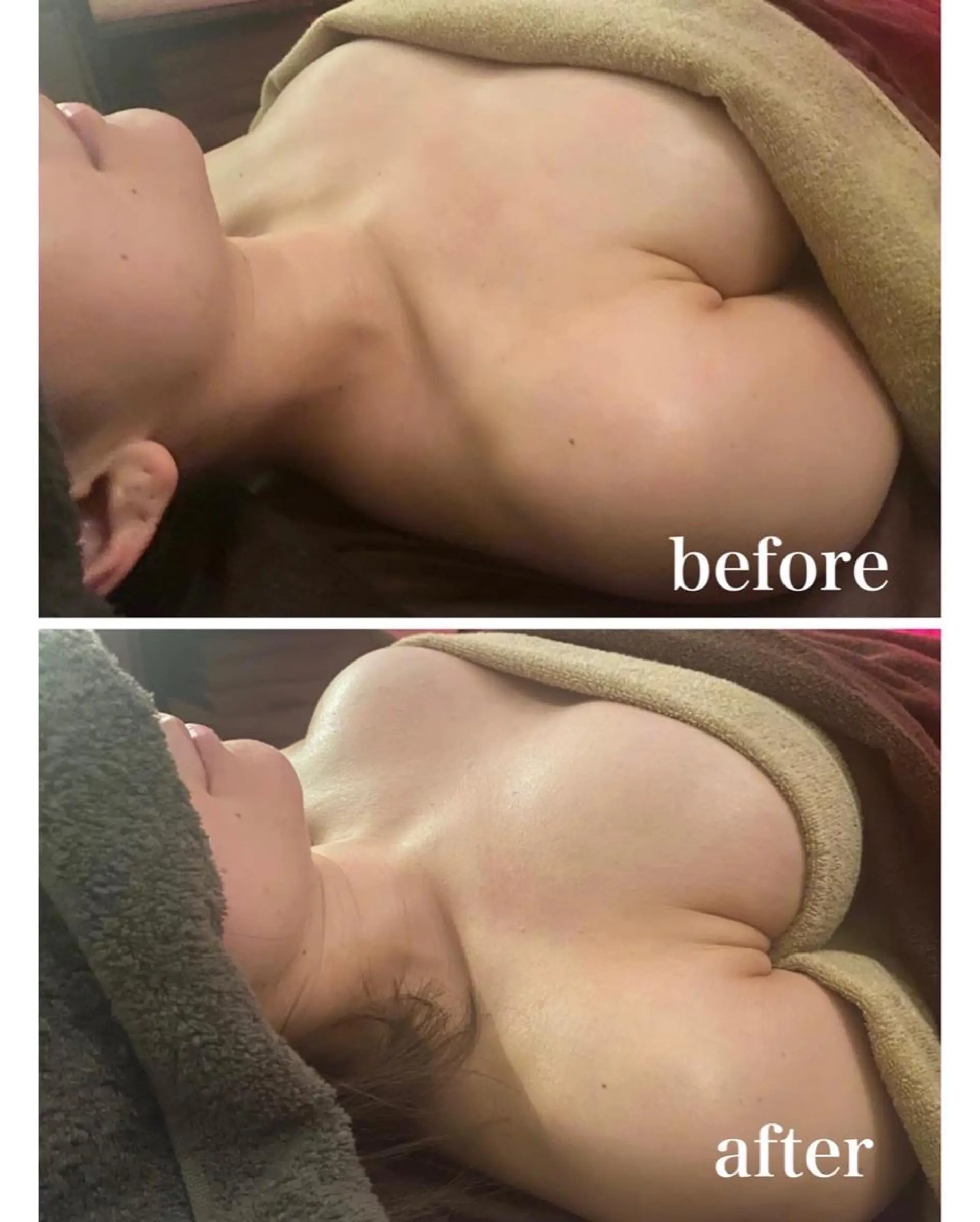 美容鍼灸サロン YOSHINOのエステ・リラクイメージ