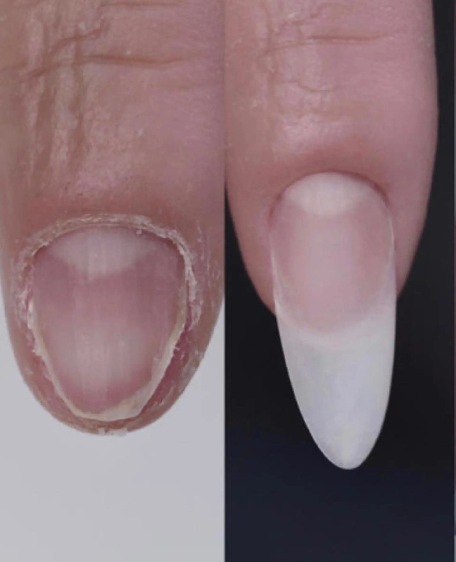 ネイル MoonNail ナナのネイルデザイン